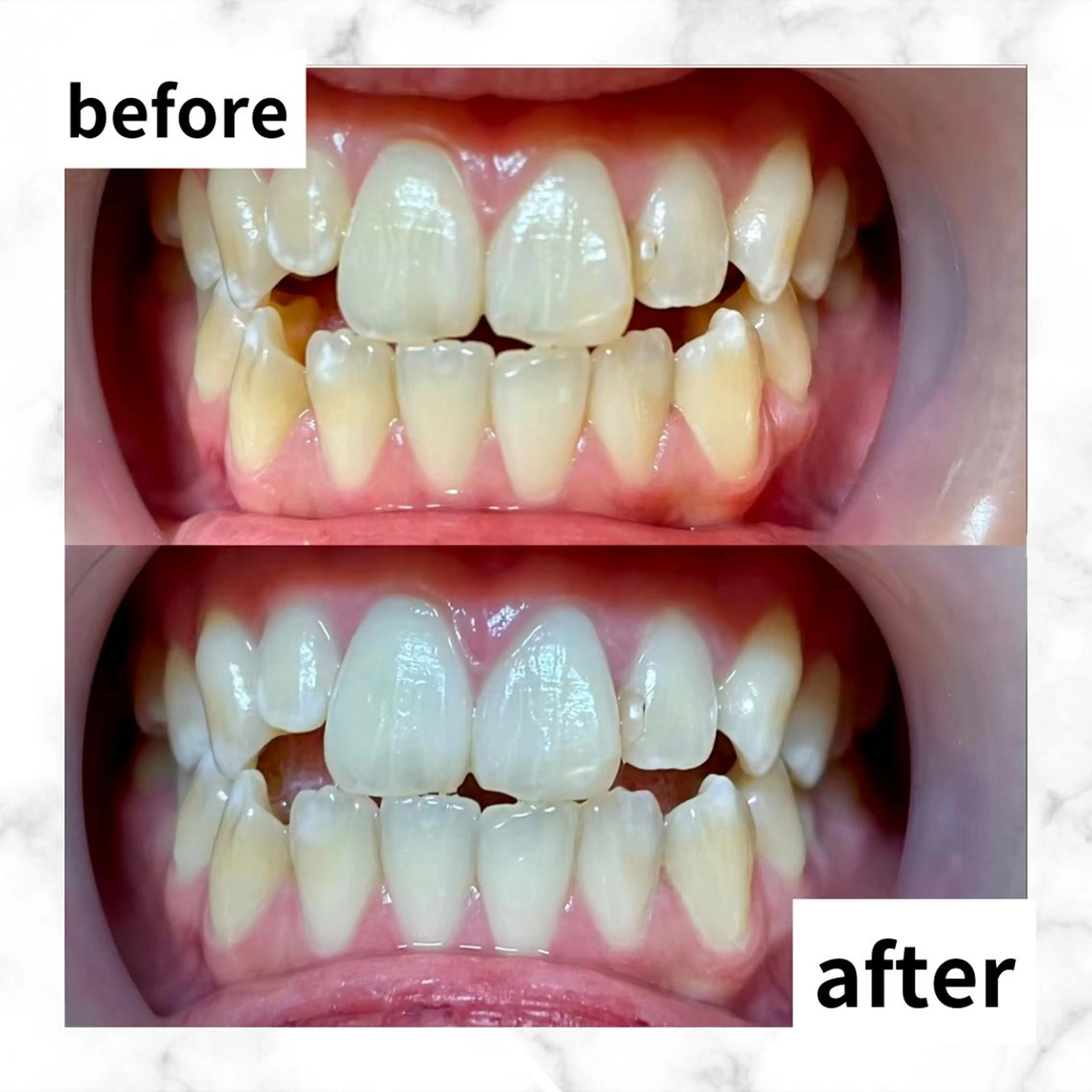 LBSホワイトニング 🌐渋谷店 河内のエステ・リラクイメージ