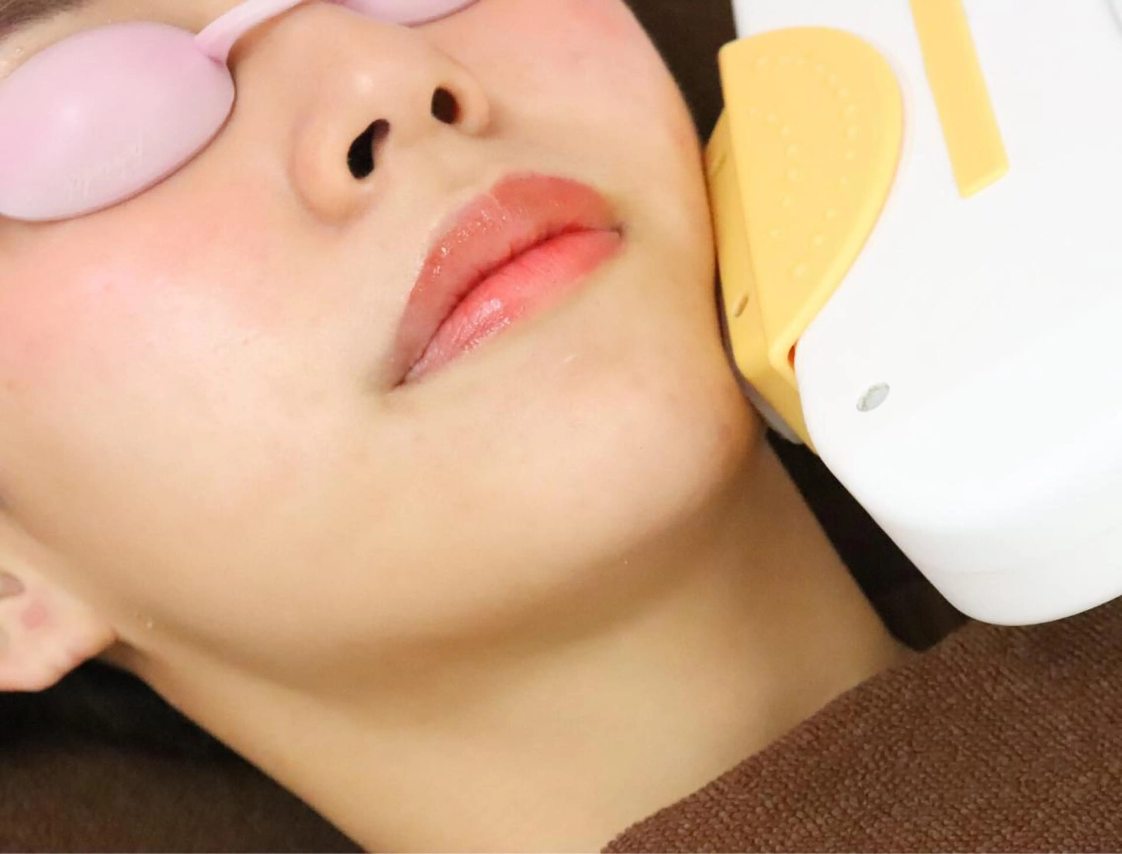 《何度でも利用OK》顔脱毛！産毛対応の脱毛機を使用⭐︎の写真