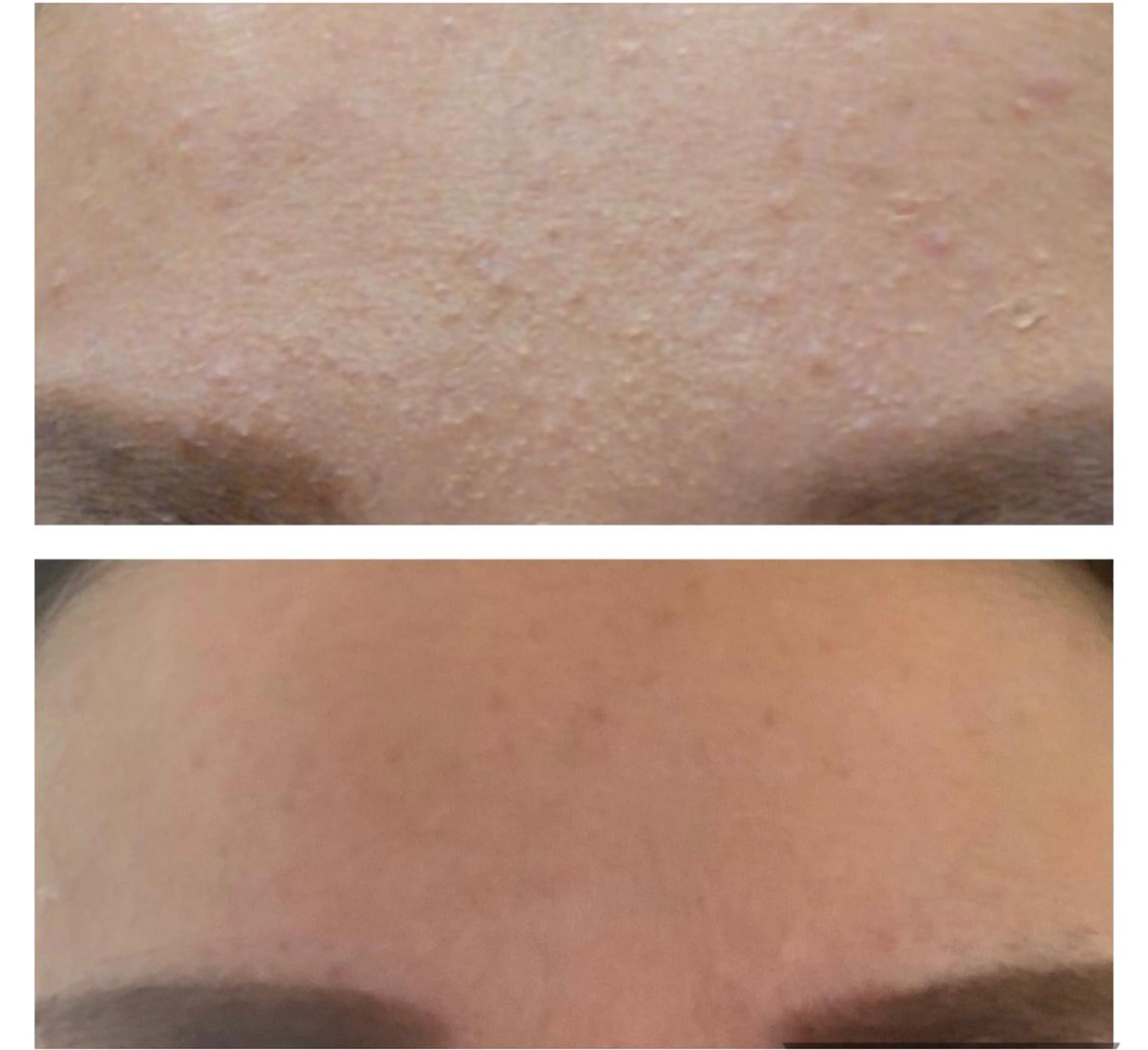 癒し腸もみサロン シャユーム　ゆきなのエステ・リラクイメージ