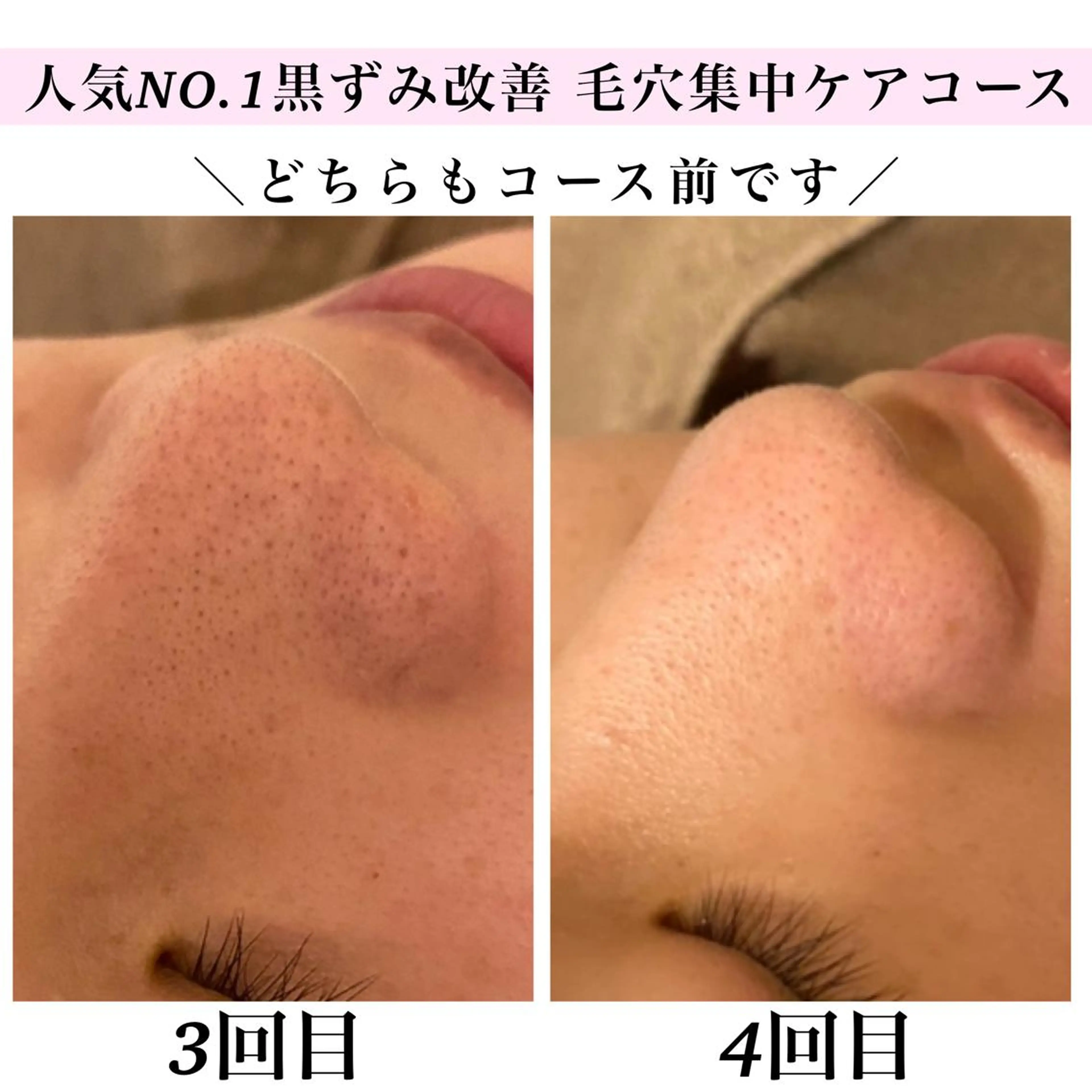 エステ リラク Bellesthe (ベルエステ)のエステ・リラクイメージ