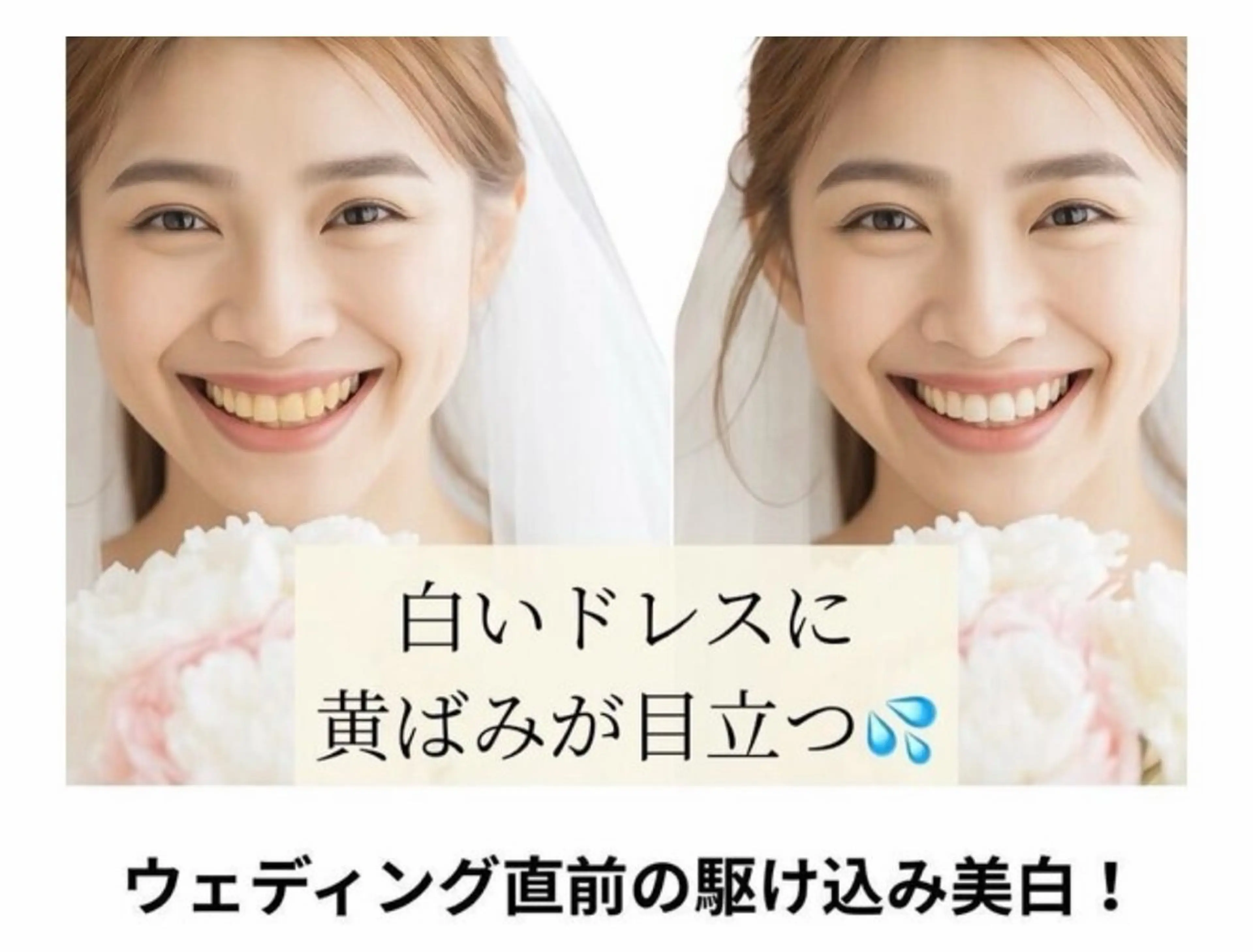 エミルカ　自由が丘店所属・ニキビ改善ハーブ🌿 ハナシマのその他イメージ