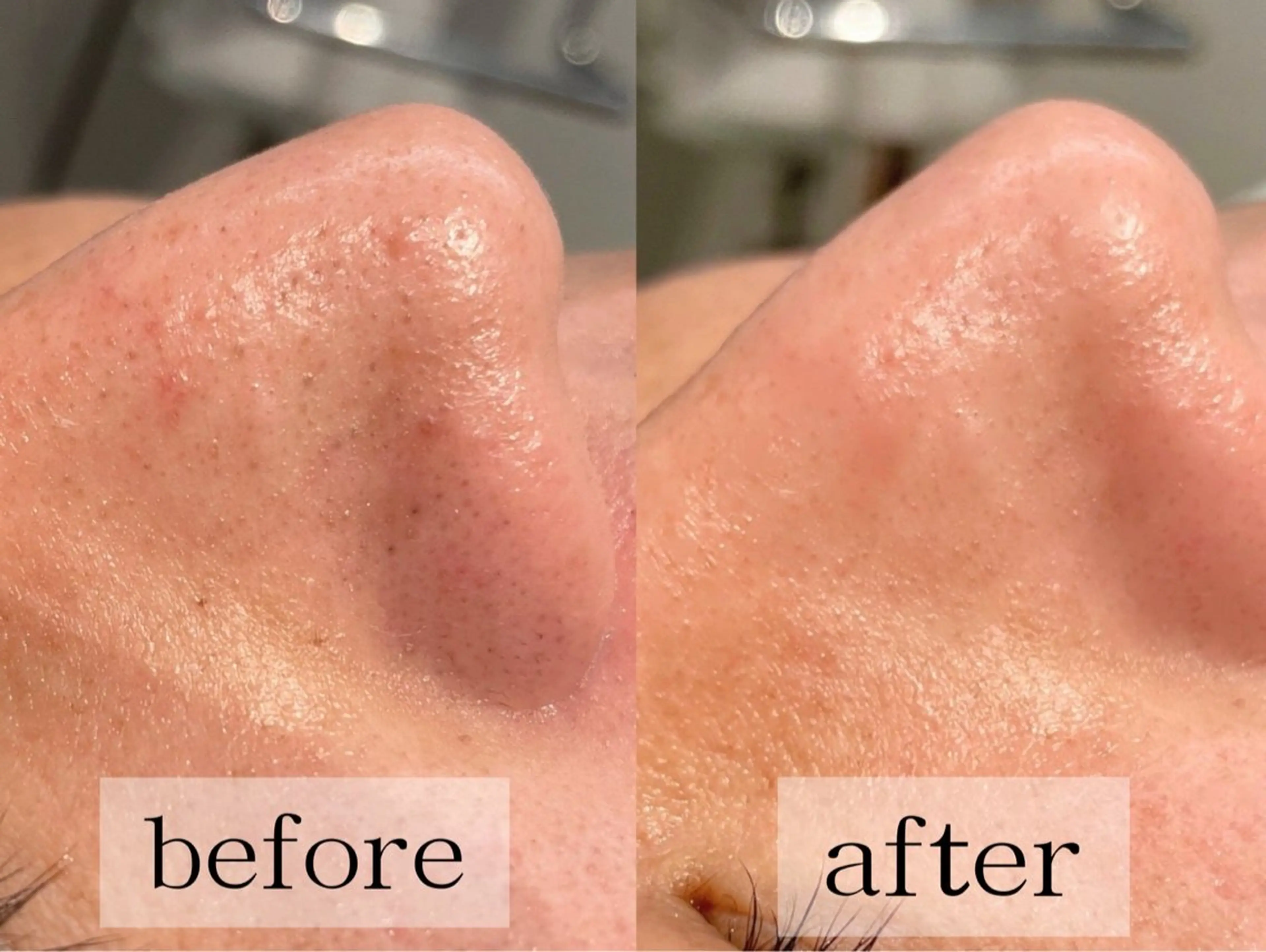 毛穴・肌質ケア専門 グランビューティーのエステ・リラクイメージ