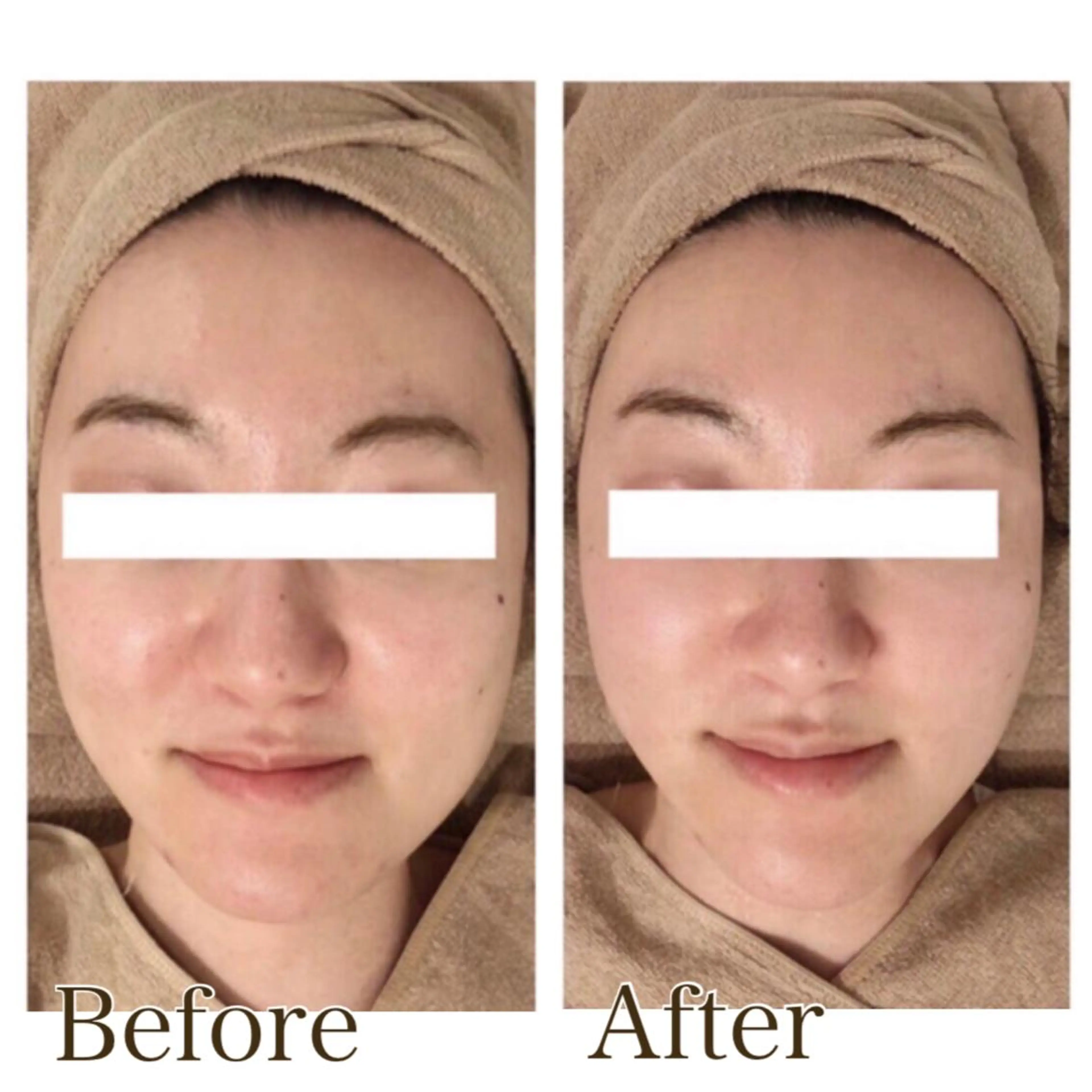 MiMiy 銀座店のエステ・リラクイメージ