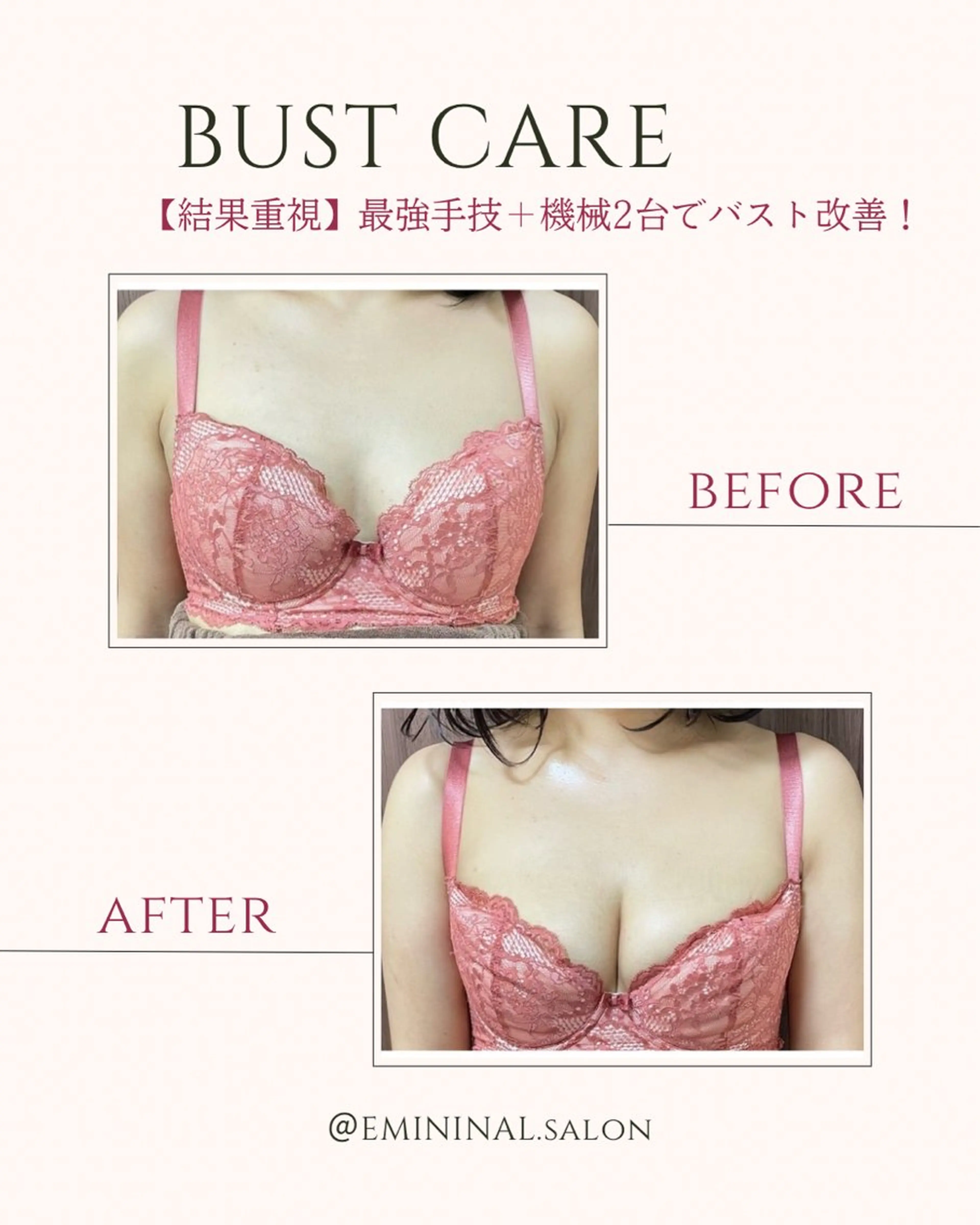 エステ EMININAL salon所属・鈴木 映子のエステ・リラクイメージ