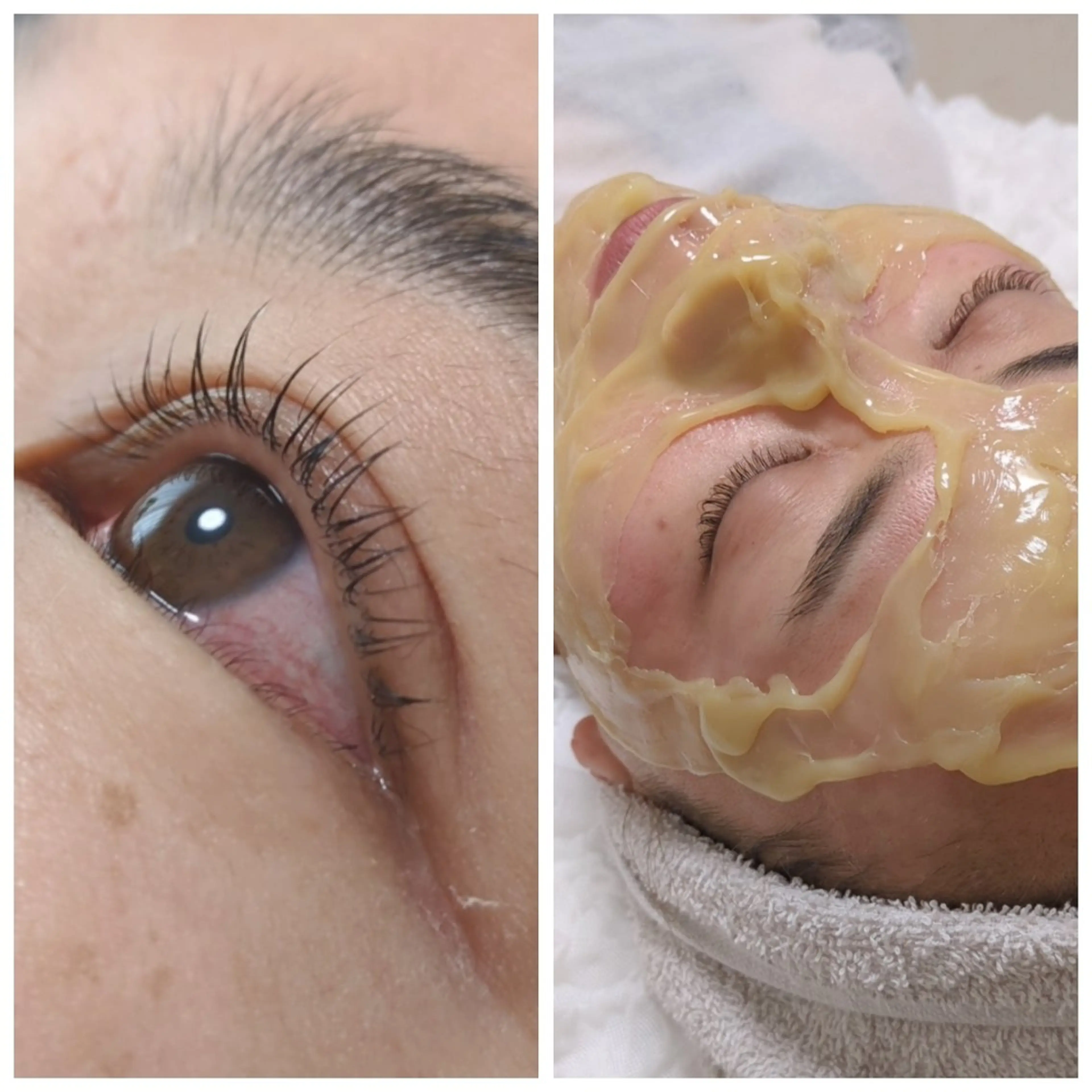 冬の乾燥にバリア機能を高める◎限定価格！バイオウォーミーパック(松ヤニ)とまつパ＊お得コース＊の写真