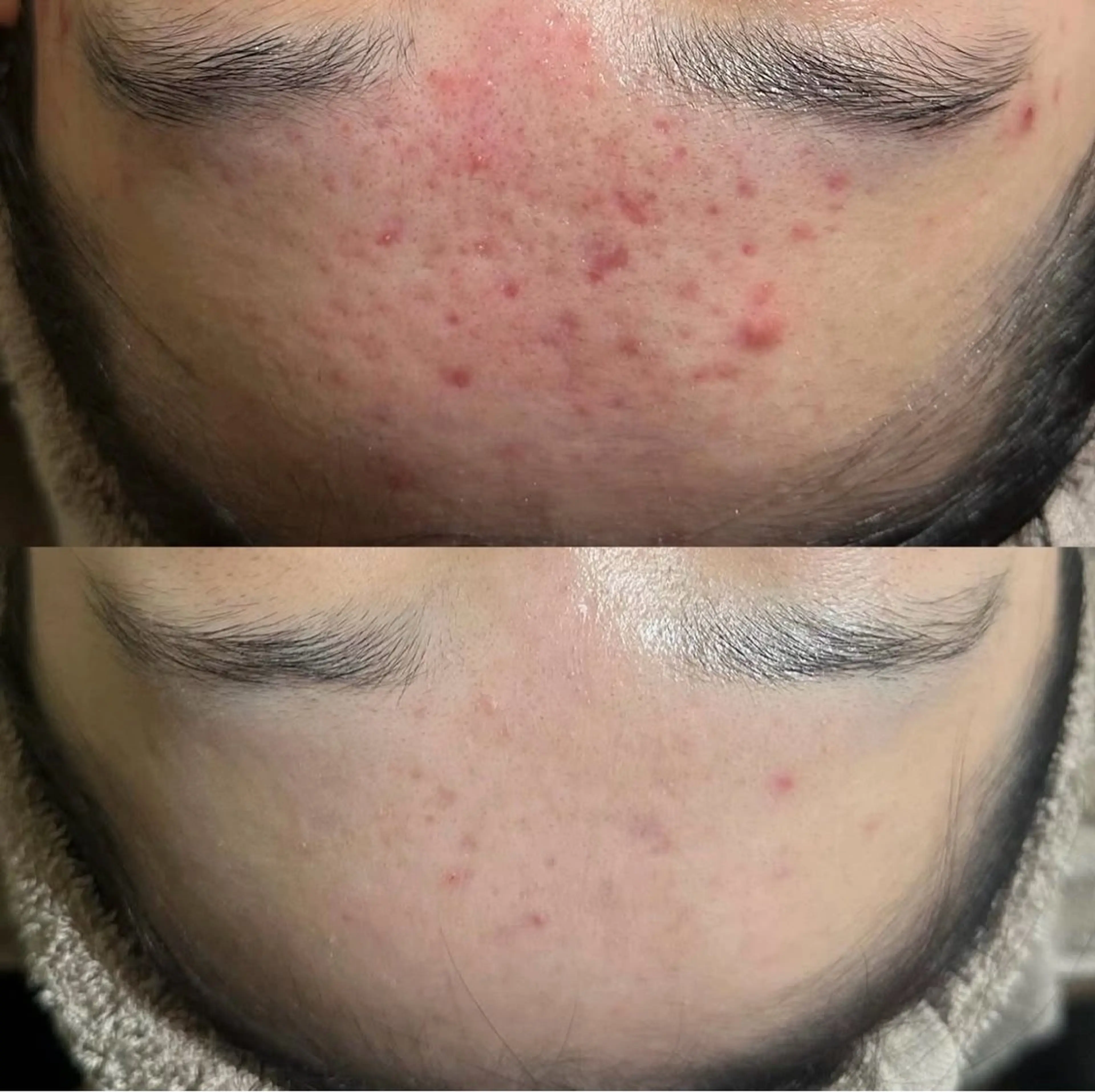 エミルカ　自由が丘店所属・花島 悠のエステ・リラクイメージ