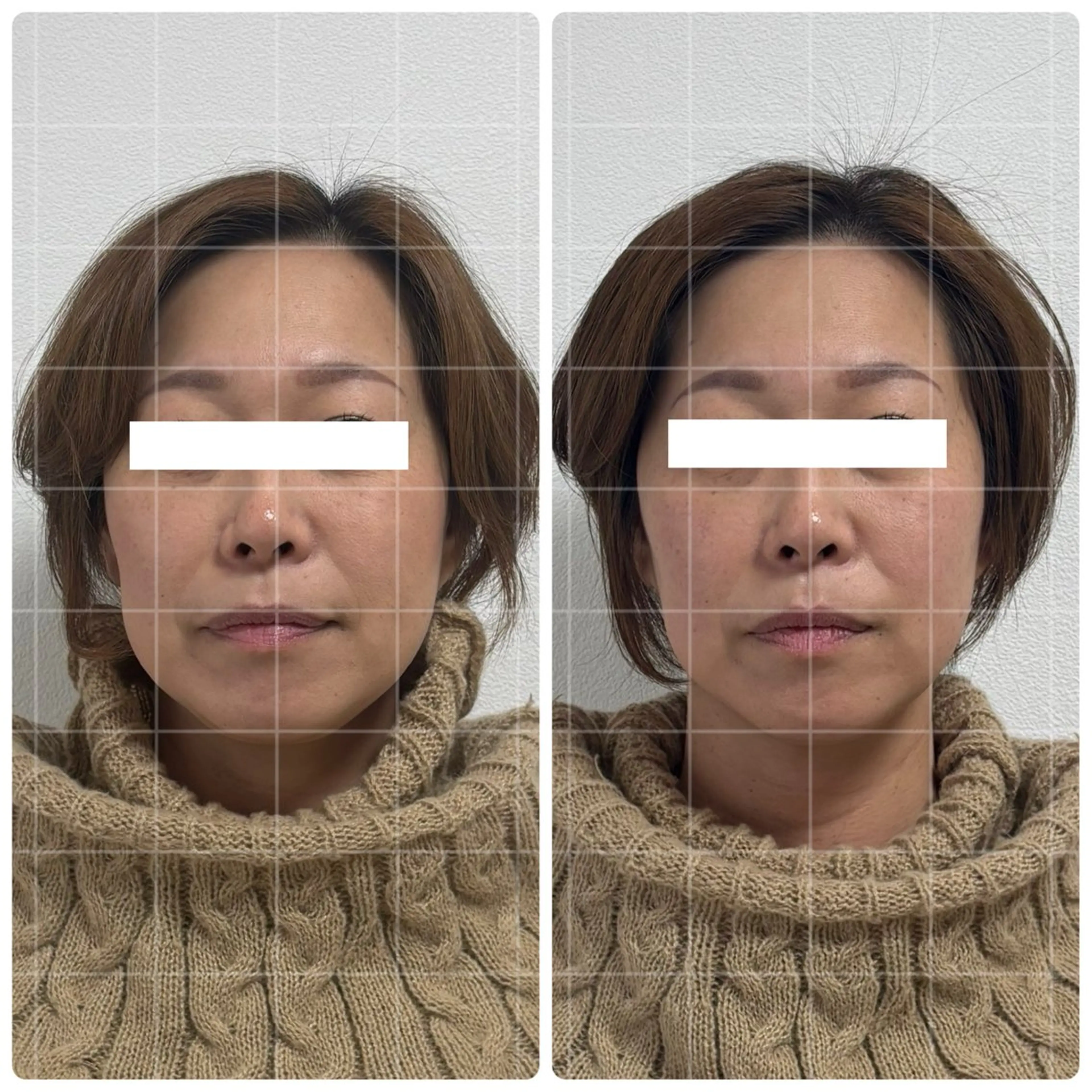 くつろぎ小顔サロン Lu mellow所属・片山けいこ｜ 美人顔創りの専門家のエステ・リラクイメージ