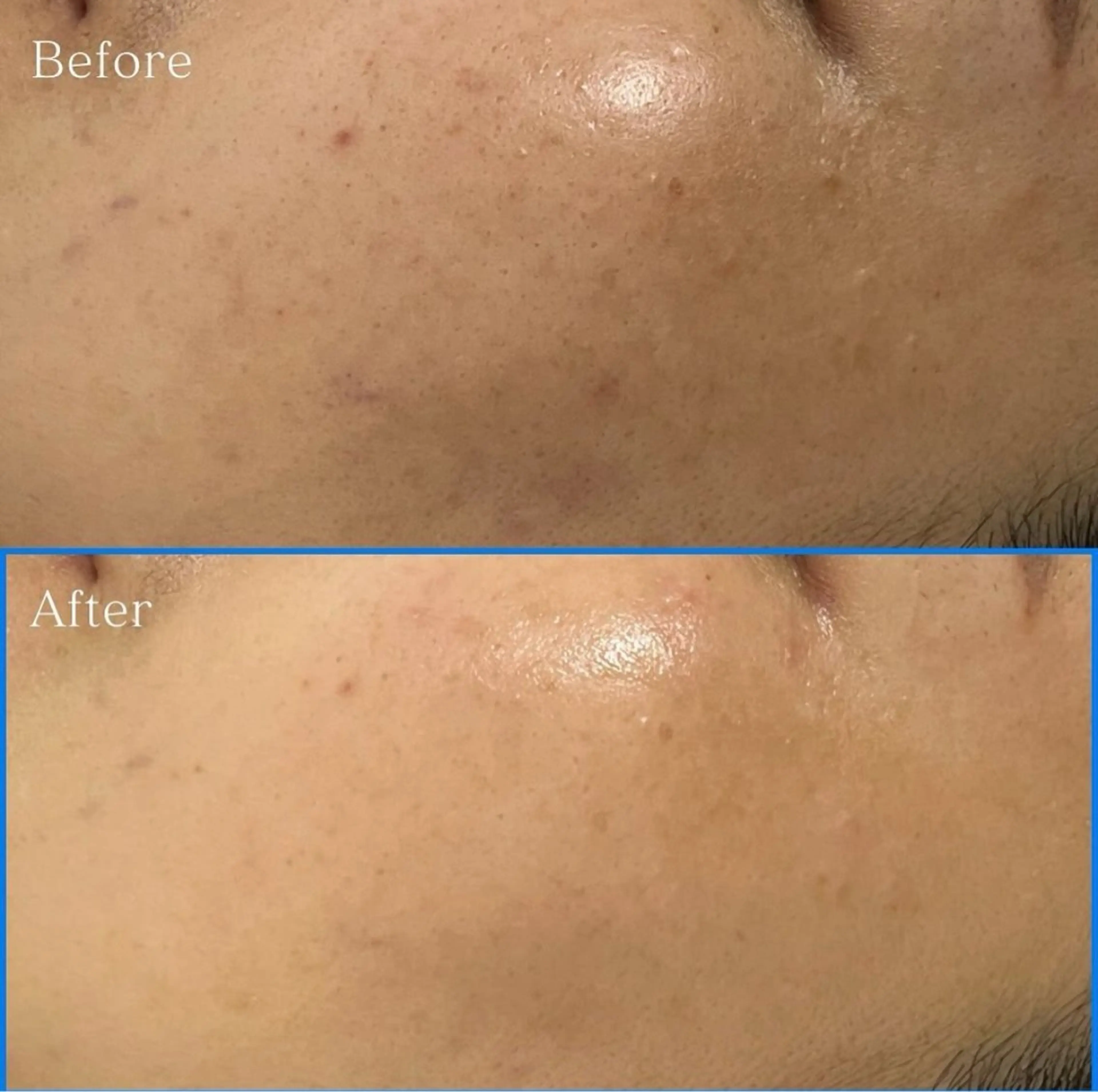 エステティックサロンVive所属・エステティックサロン Viveのエステ・リラクイメージ