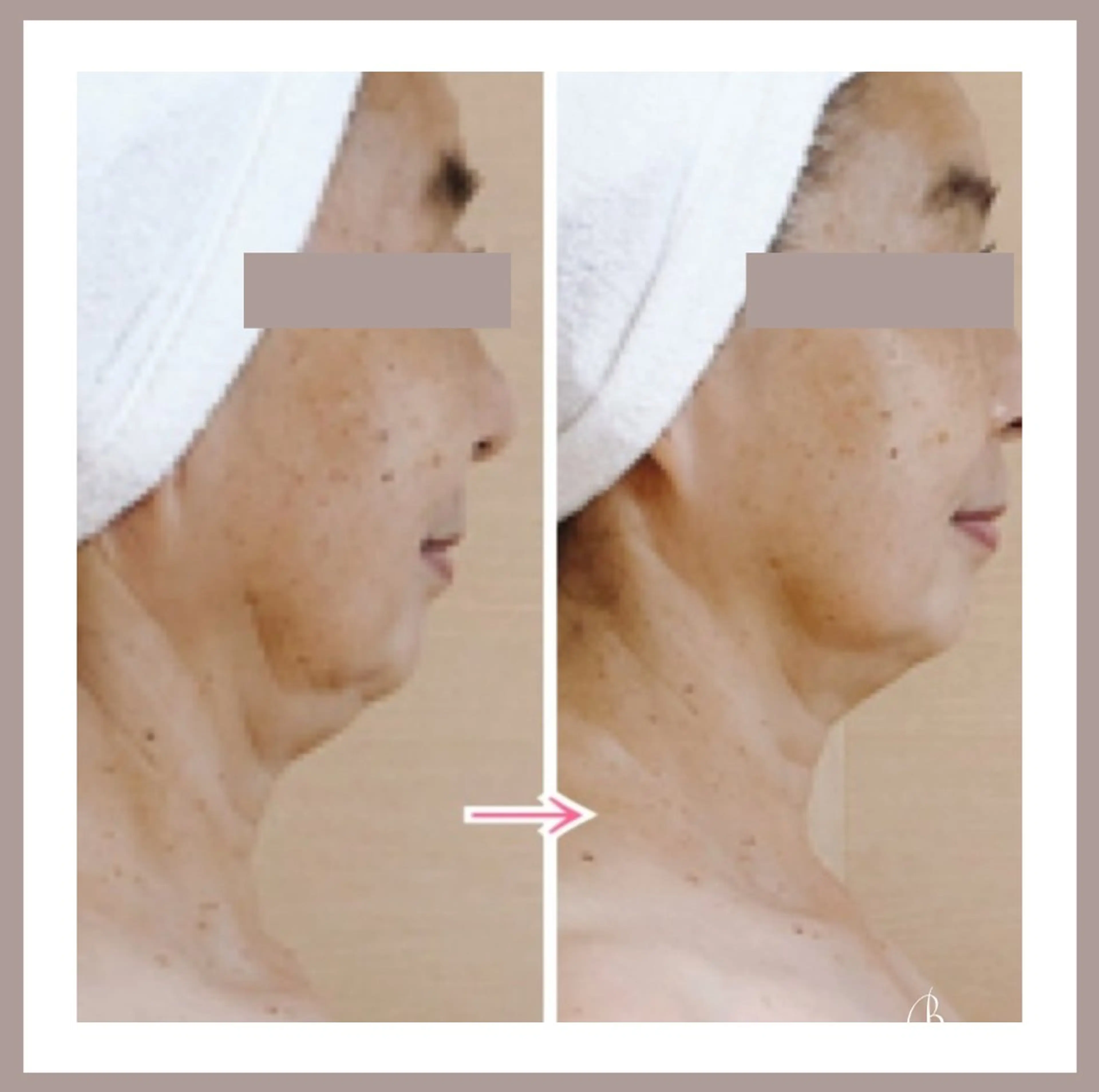 エステ 小顔・デトックスリンパ専門サロンRadiant Muse (ラディアントミューズ)所属・小顔・たるみ改善 ラディアントミューズのエステ・リラクイメージ