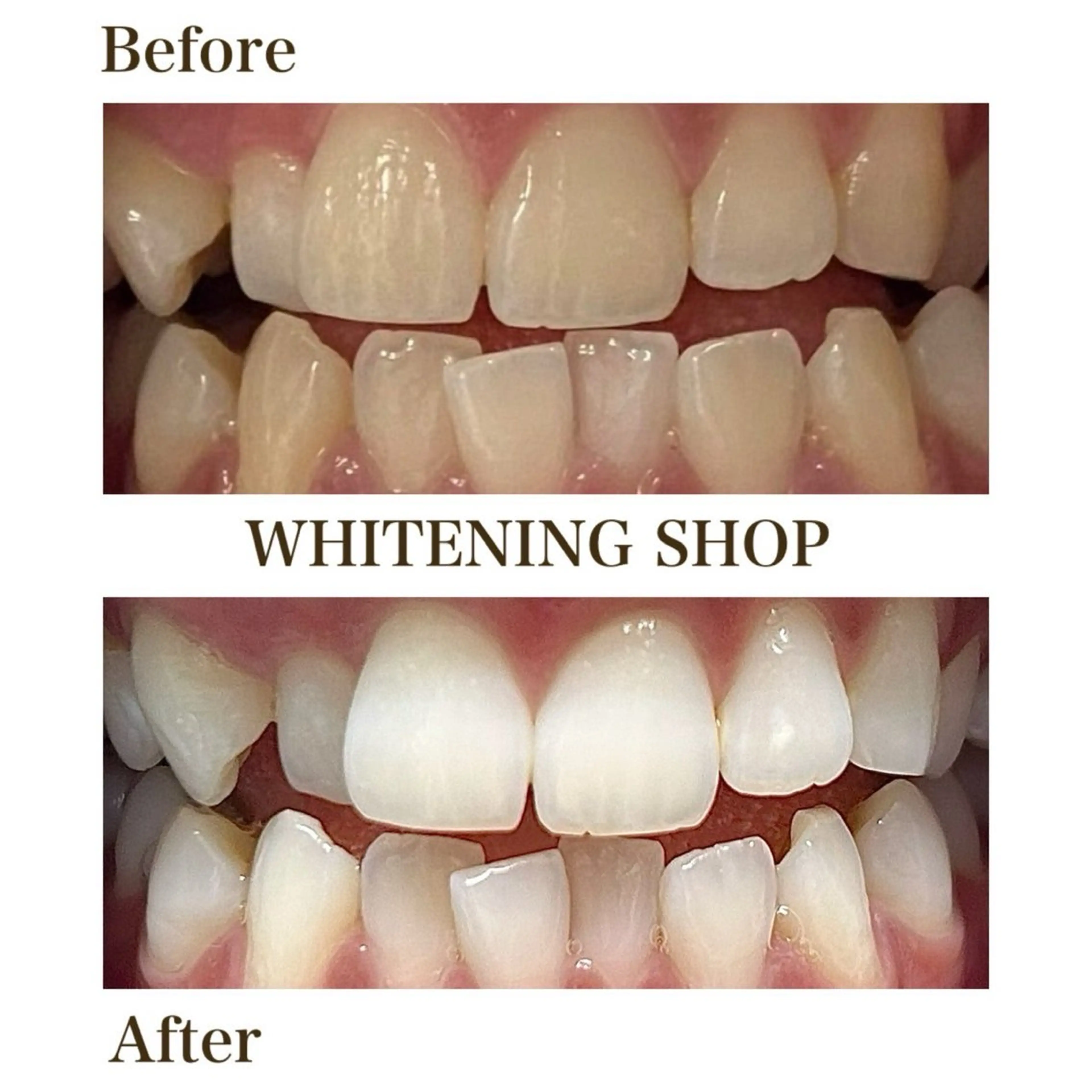 その他 ホワイトニングショップ静岡葵区店所属・ホワイトニング ショップ静岡葵区店のその他イメージ