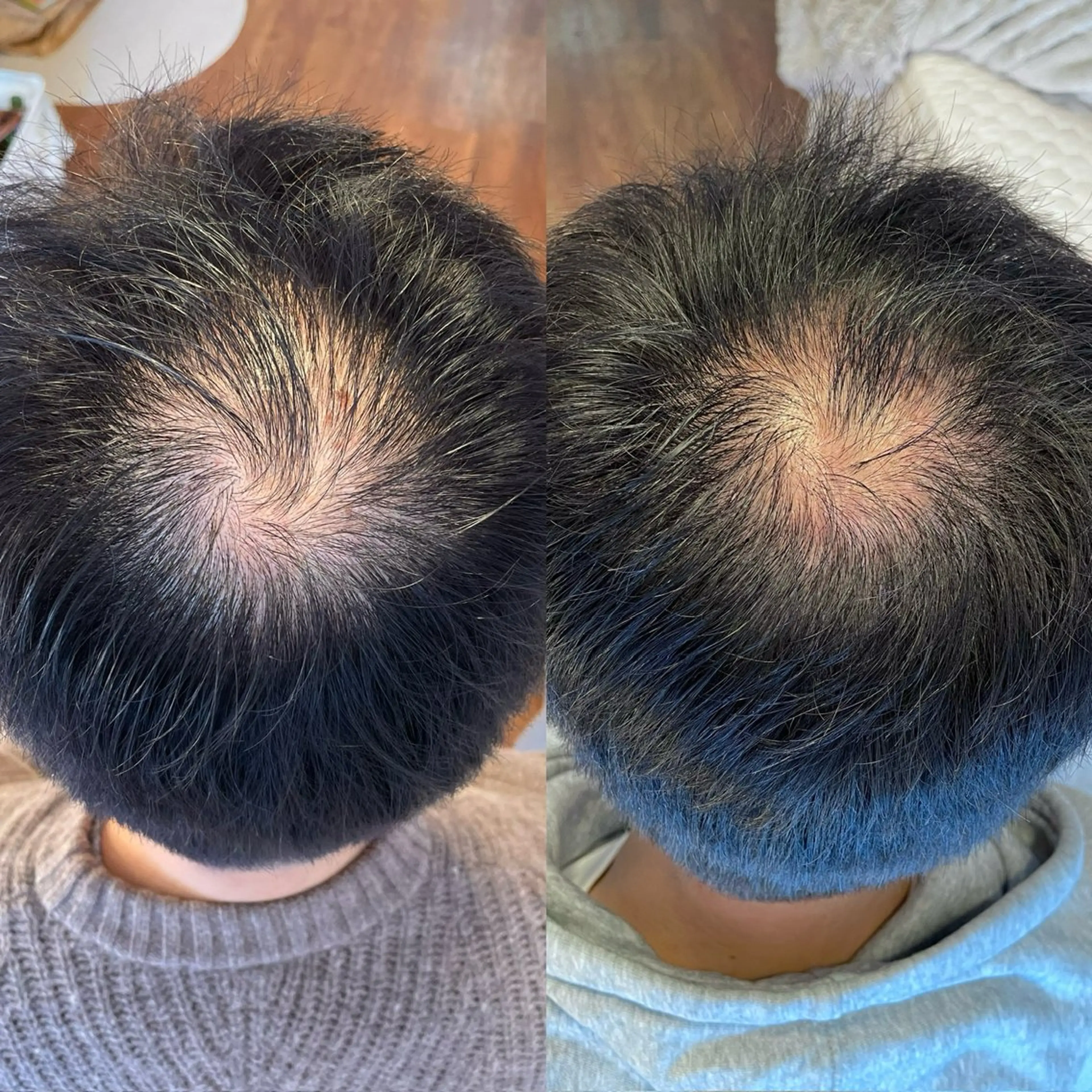 その他 毛穴専門店MeMe.八千代店所属・\毛穴・頭皮/ のお悩みに特化💪のその他イメージ