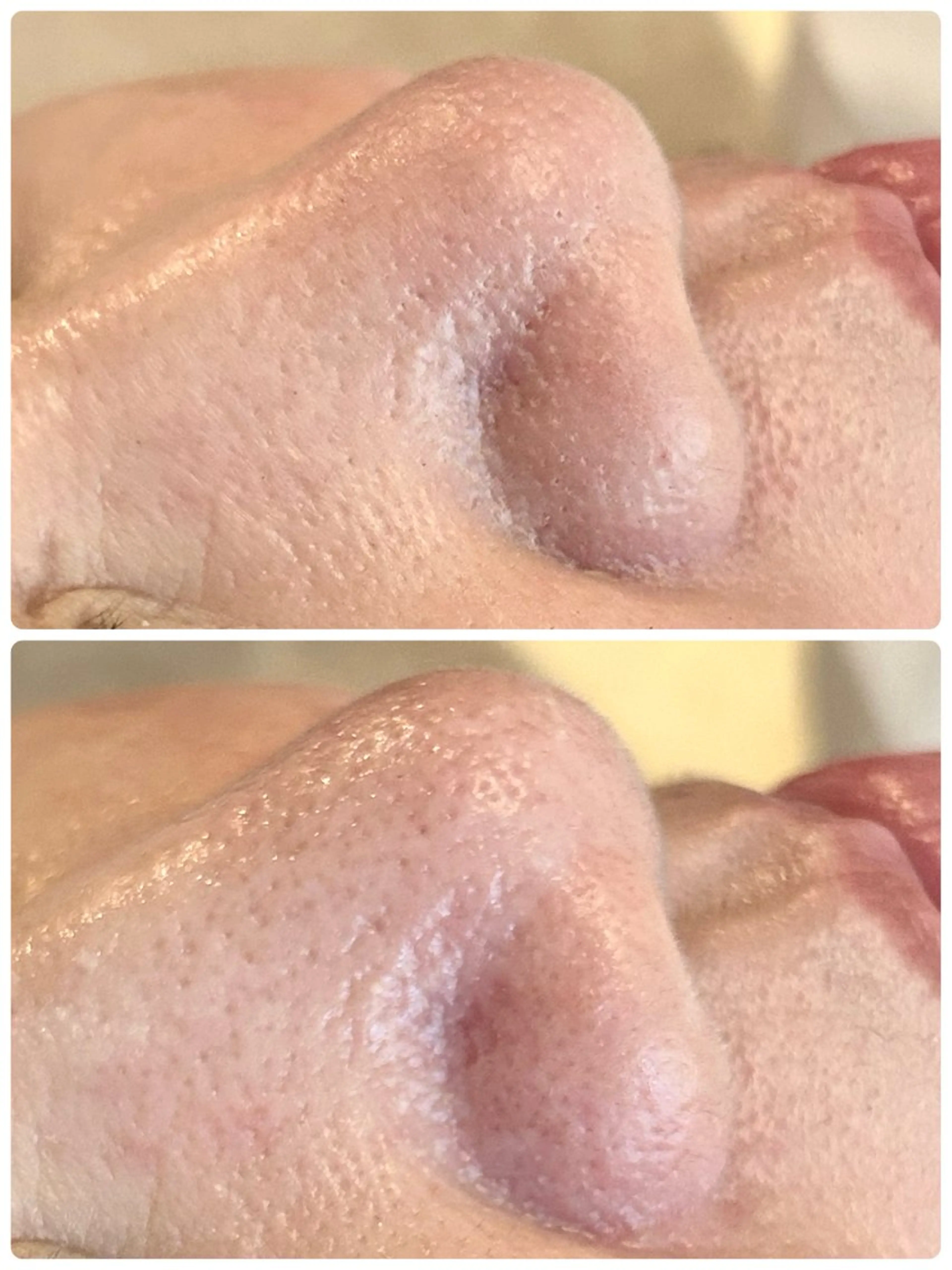 エステ リラク 鍼灸•マッサージサロンCalfa所属・《美肌･小顔》美容鍼 ＆マッサージ＊MEIのエステ・リラクイメージ