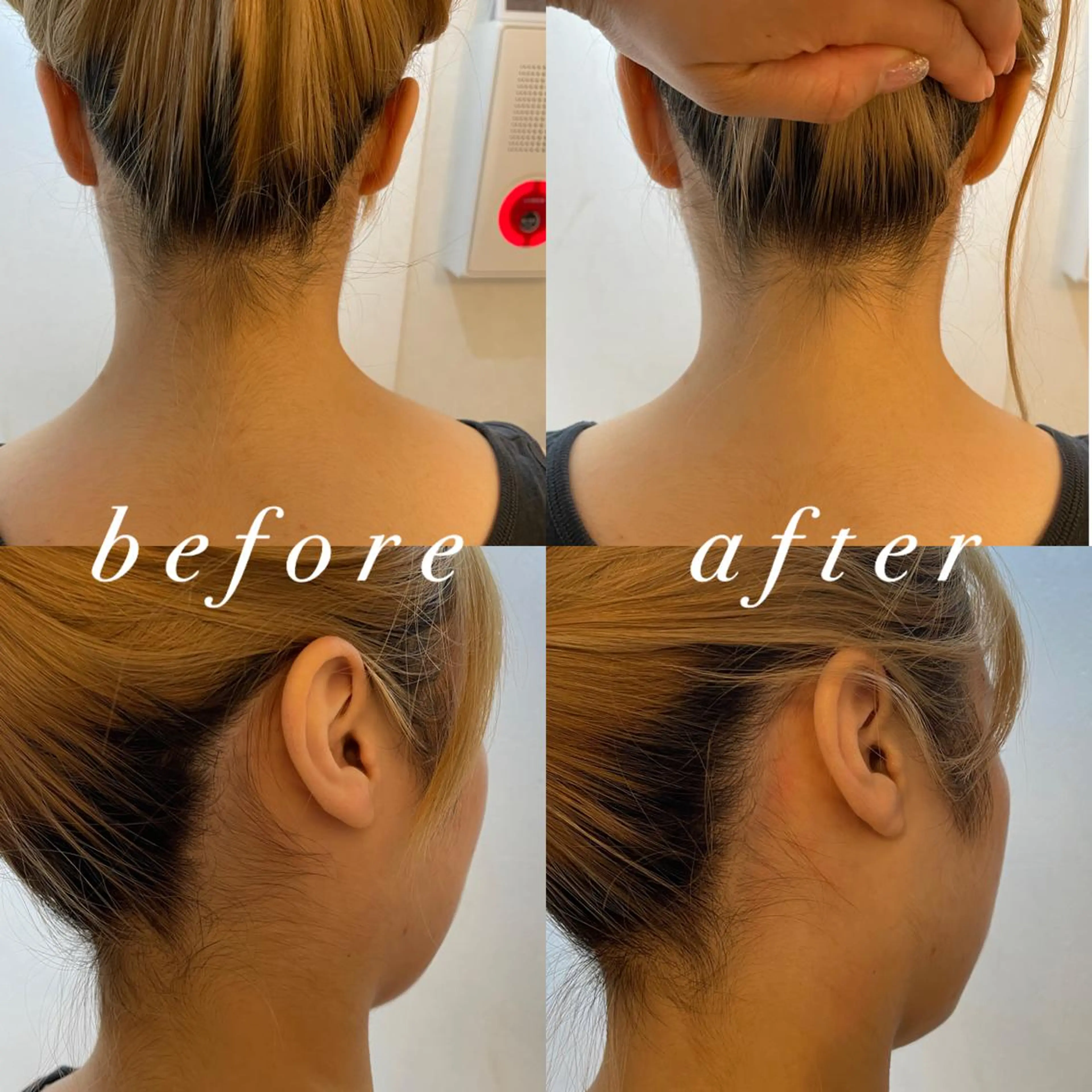 うなじ脱毛/美肌脱毛 LABELのエステ・リラクイメージ