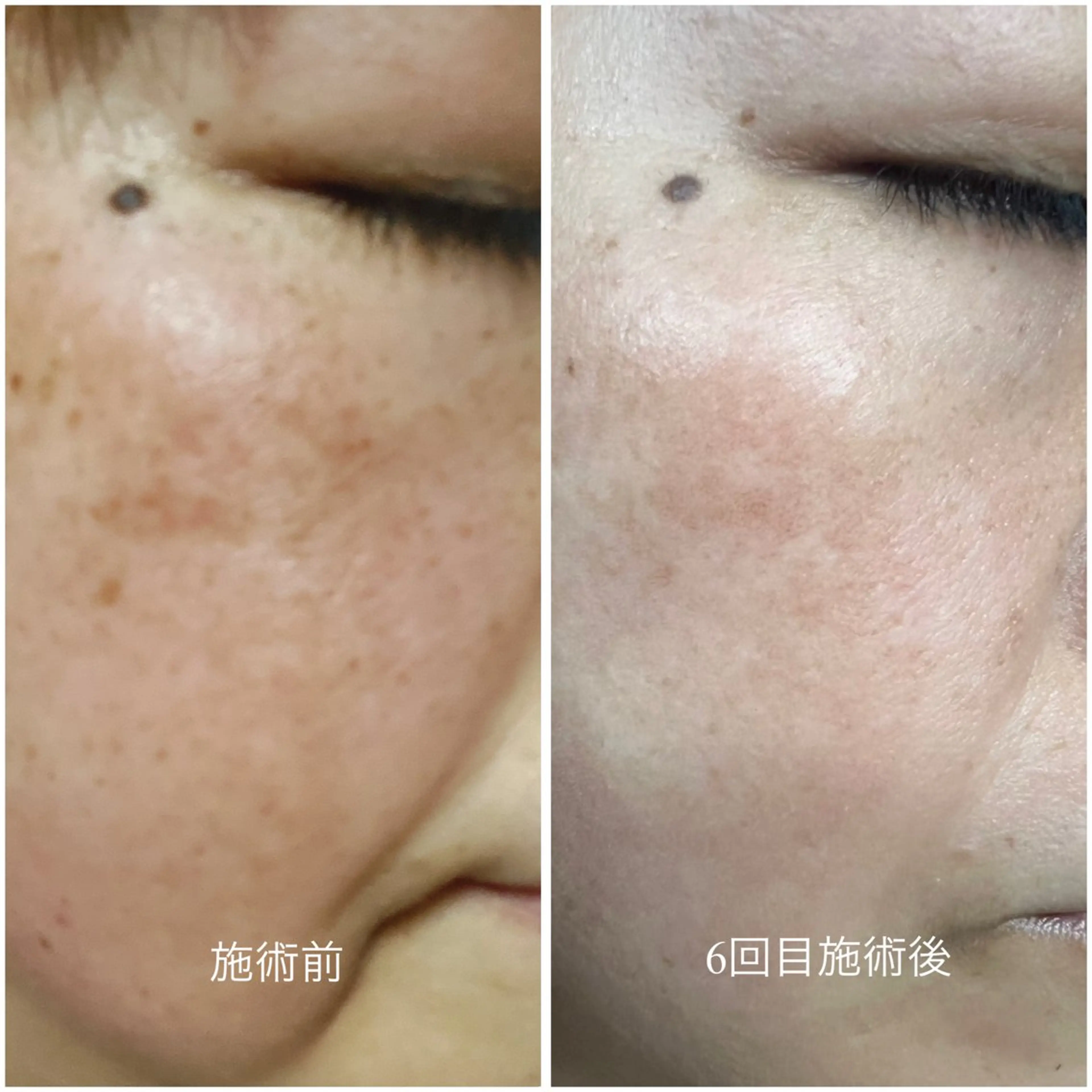 エステ スリーエスプラス内　美肌サロンEme所属・希映 -kieのエステ・リラクイメージ