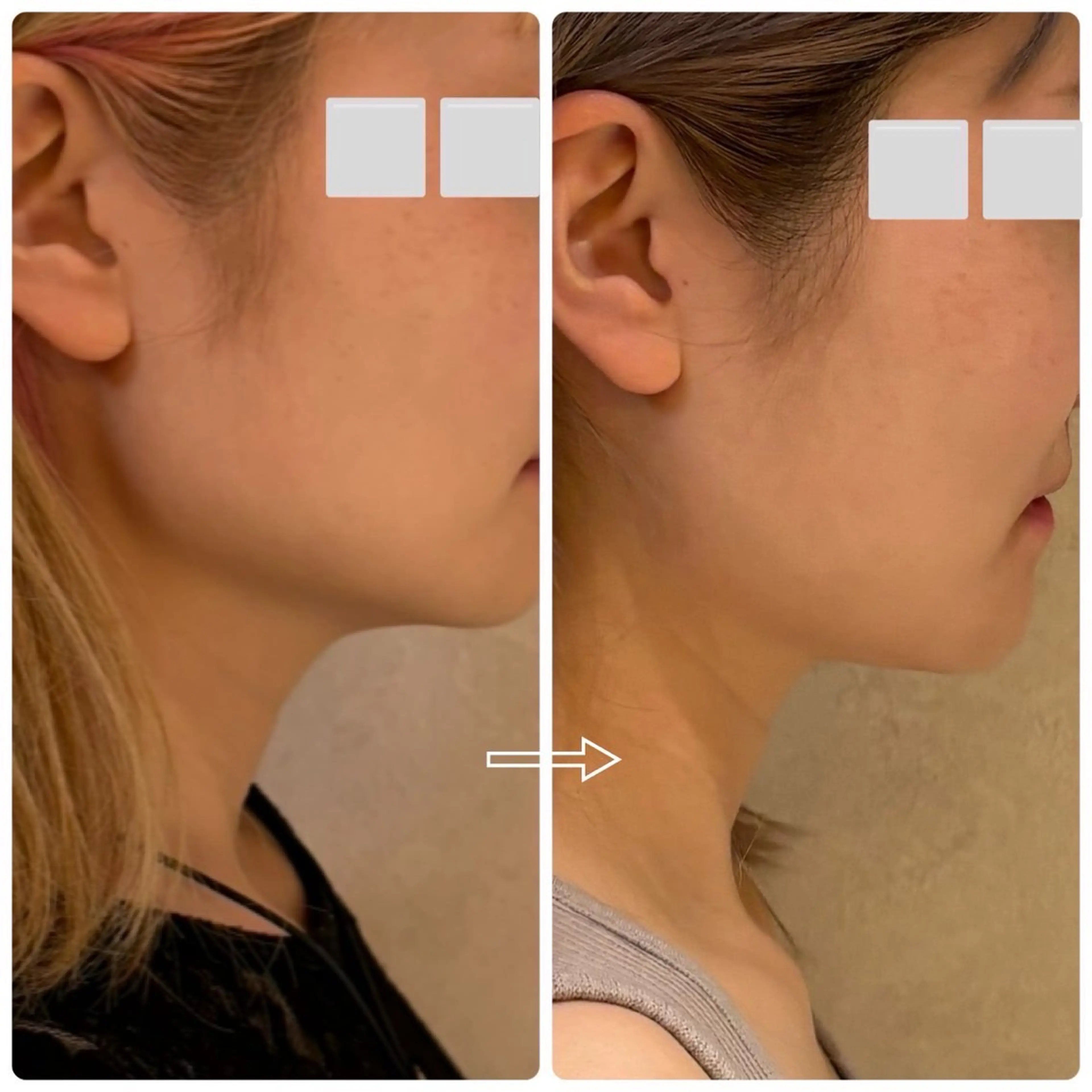 private salon.ohana所属・小顔/ララピール ohanaのエステ・リラクイメージ