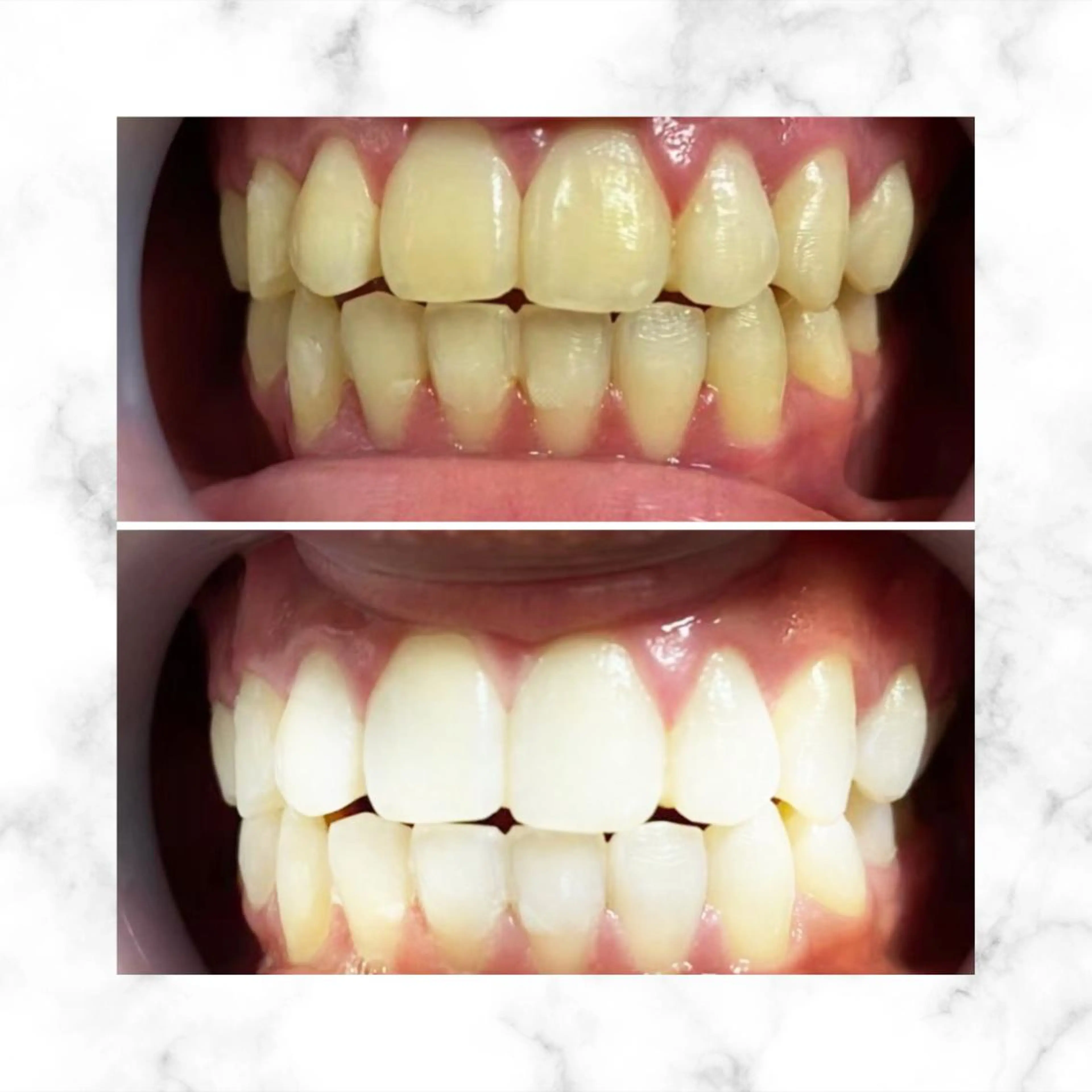 LBSホワイトニング 🌐渋谷店スタッフのエステ・リラクイメージ