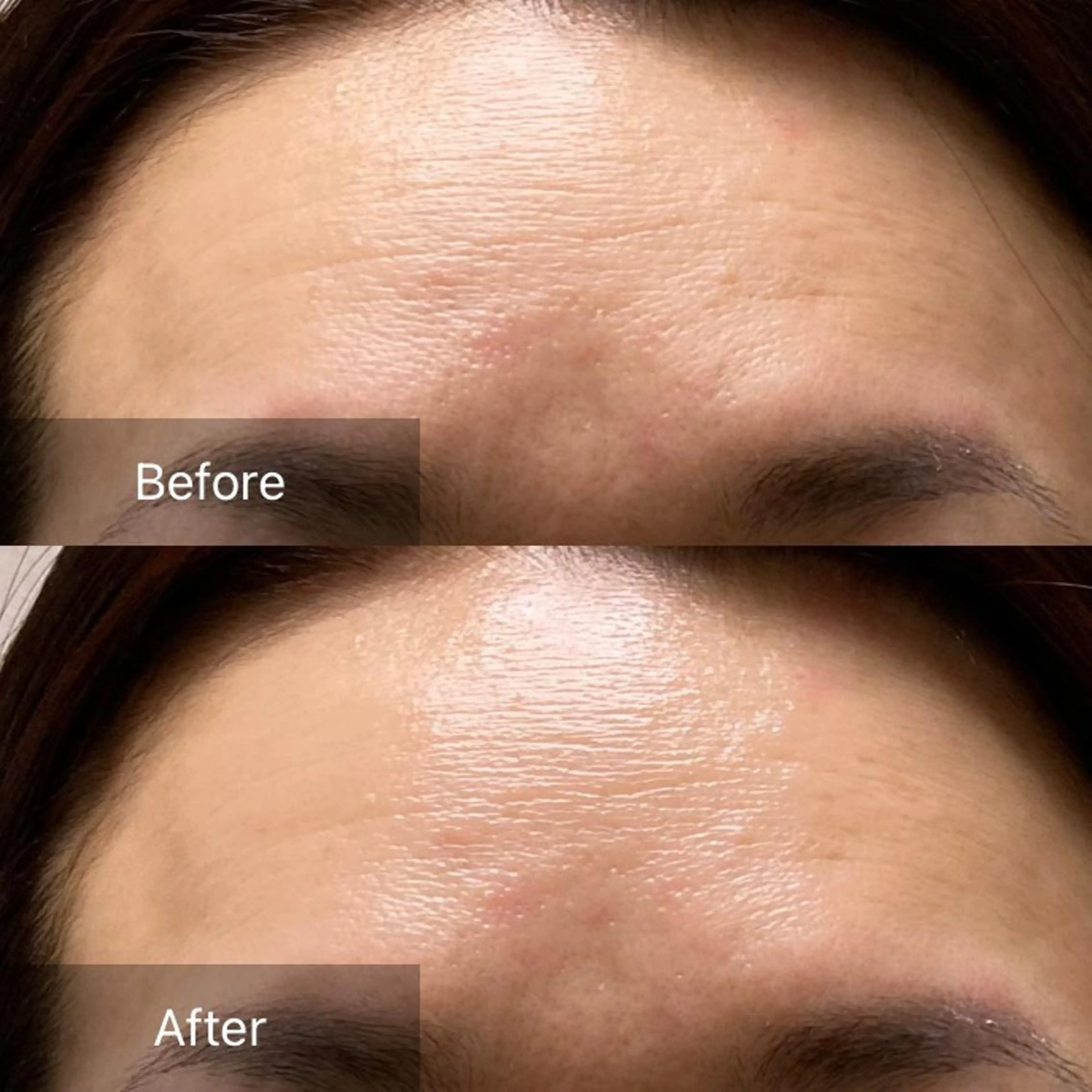 脱毛 産毛専門店 Bittoのエステ・リラクイメージ