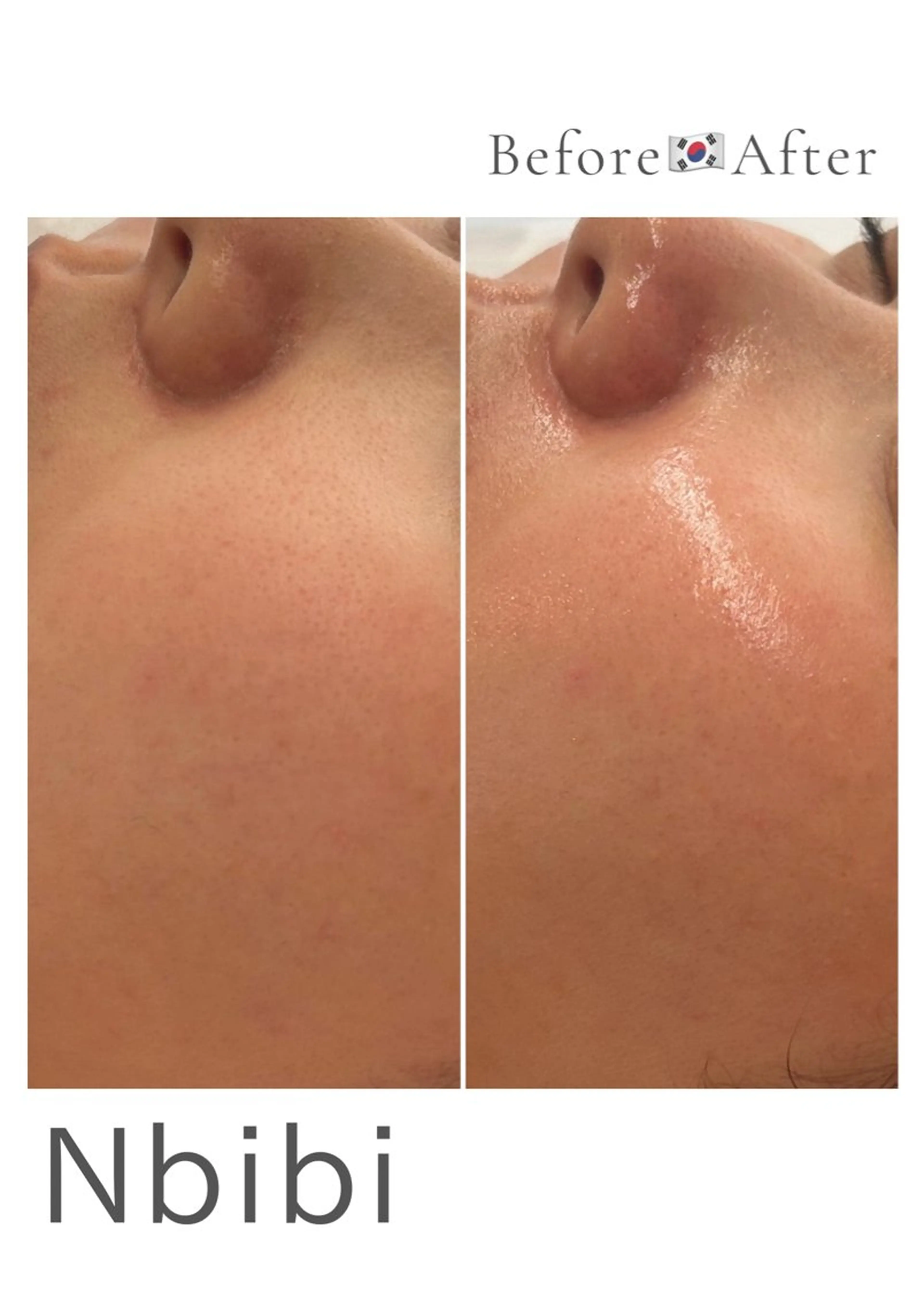 韓国🇰🇷価格 サロン_Nbibiのエステ・リラクイメージ