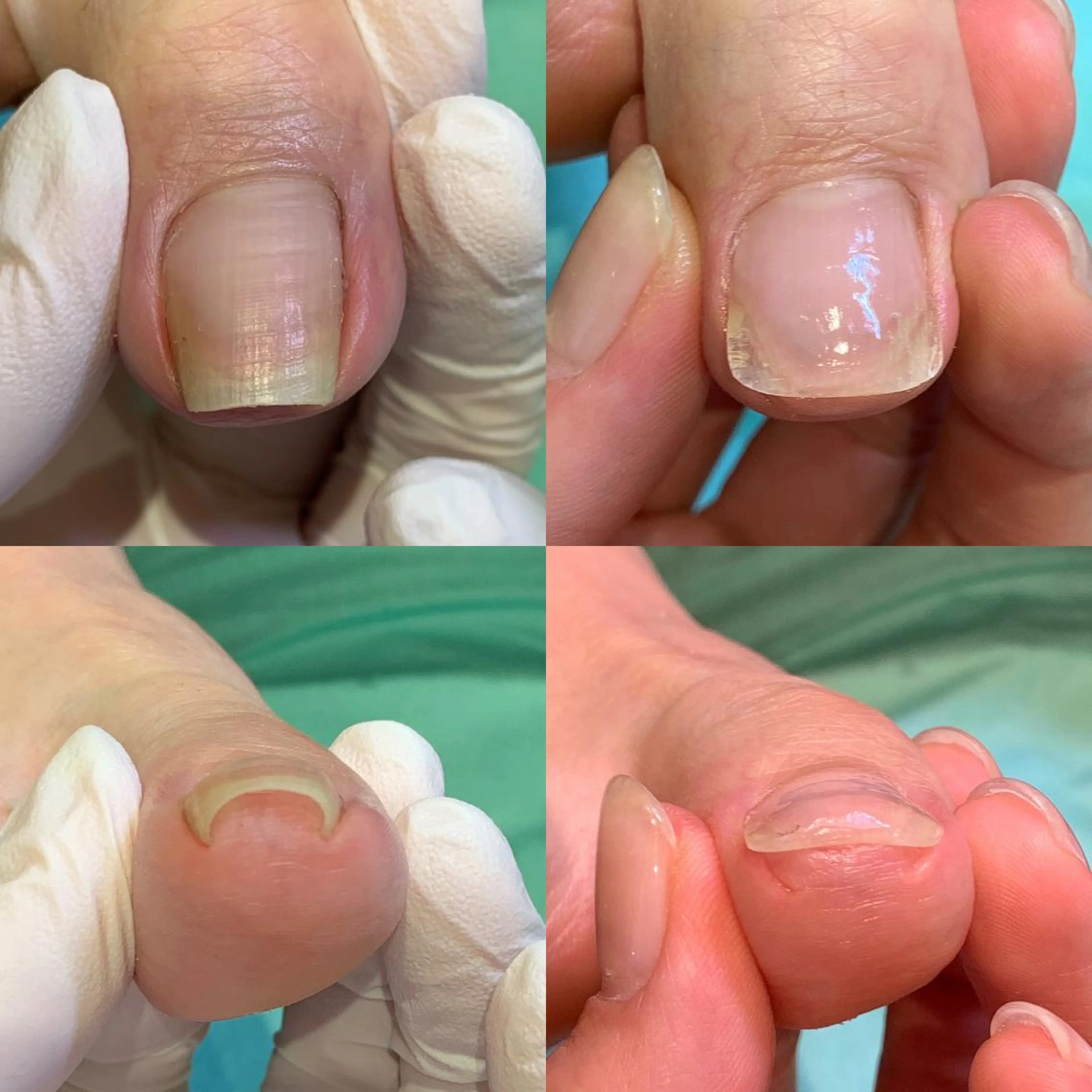 ネイル 東京巻き爪アカデミー所属・東京巻き爪 アカデミーのエステ・リラクイメージ