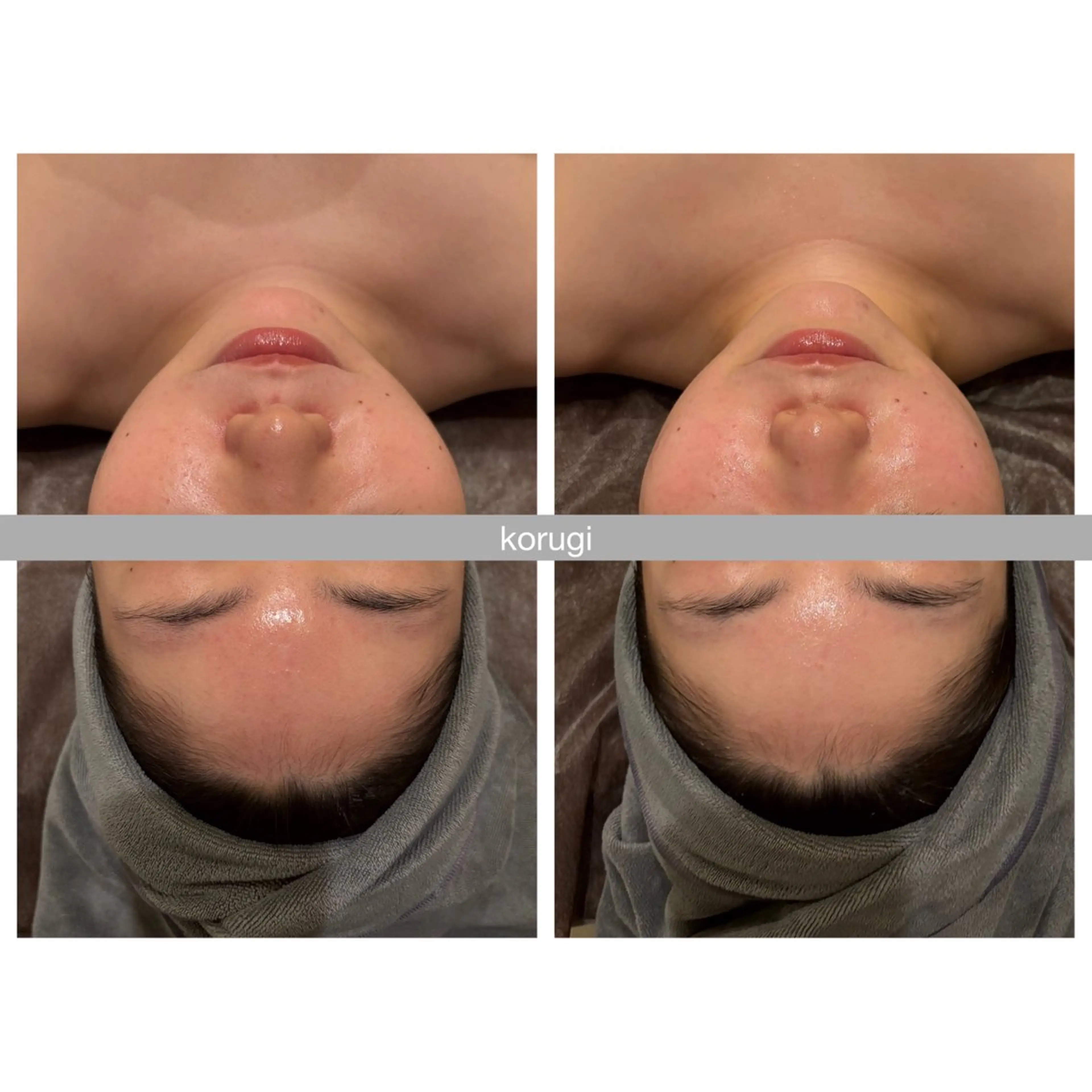 ☆痩身/小顔☆ コルギのエステ・リラクイメージ