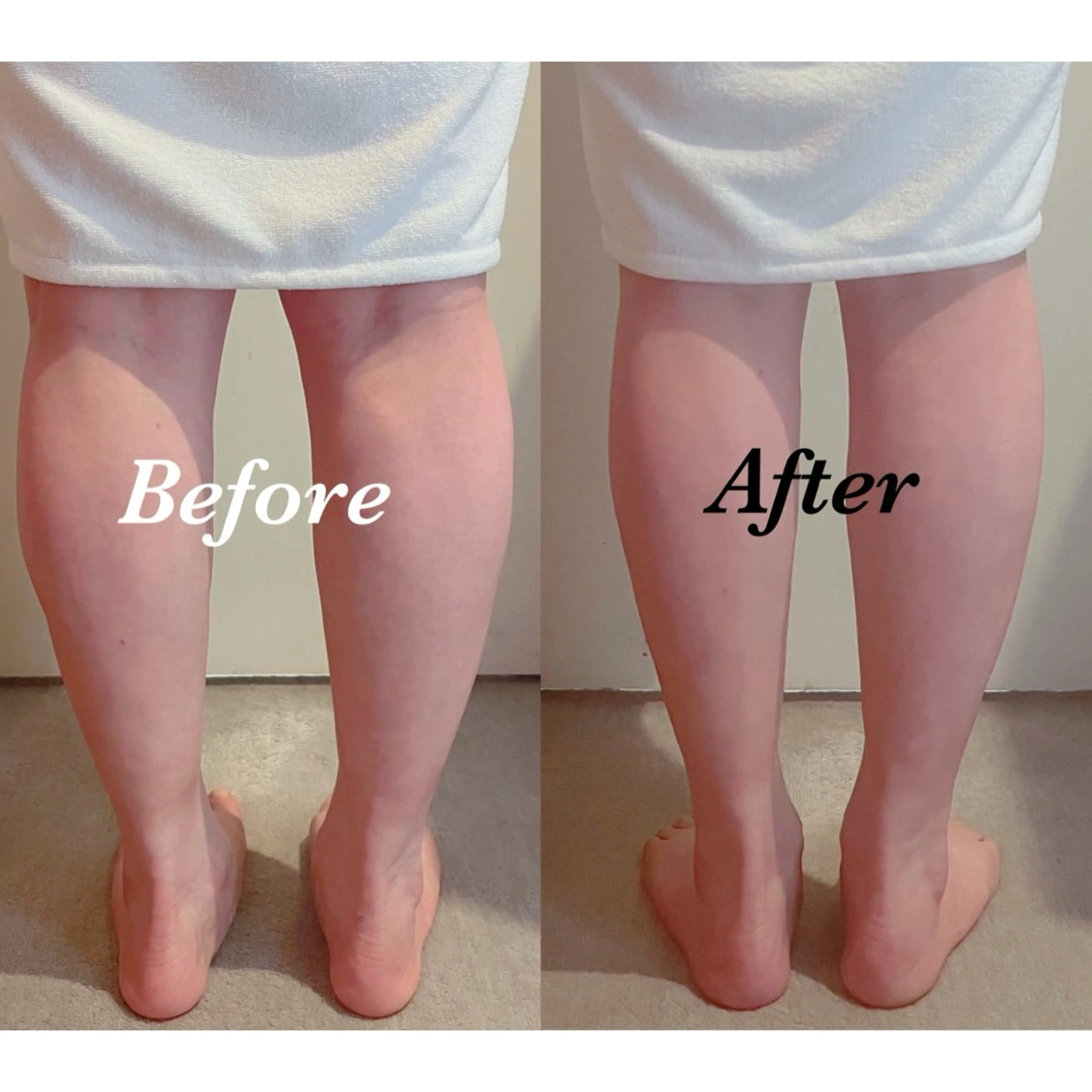 【デトックス】🦵コリ・セルライト排出リンパの写真