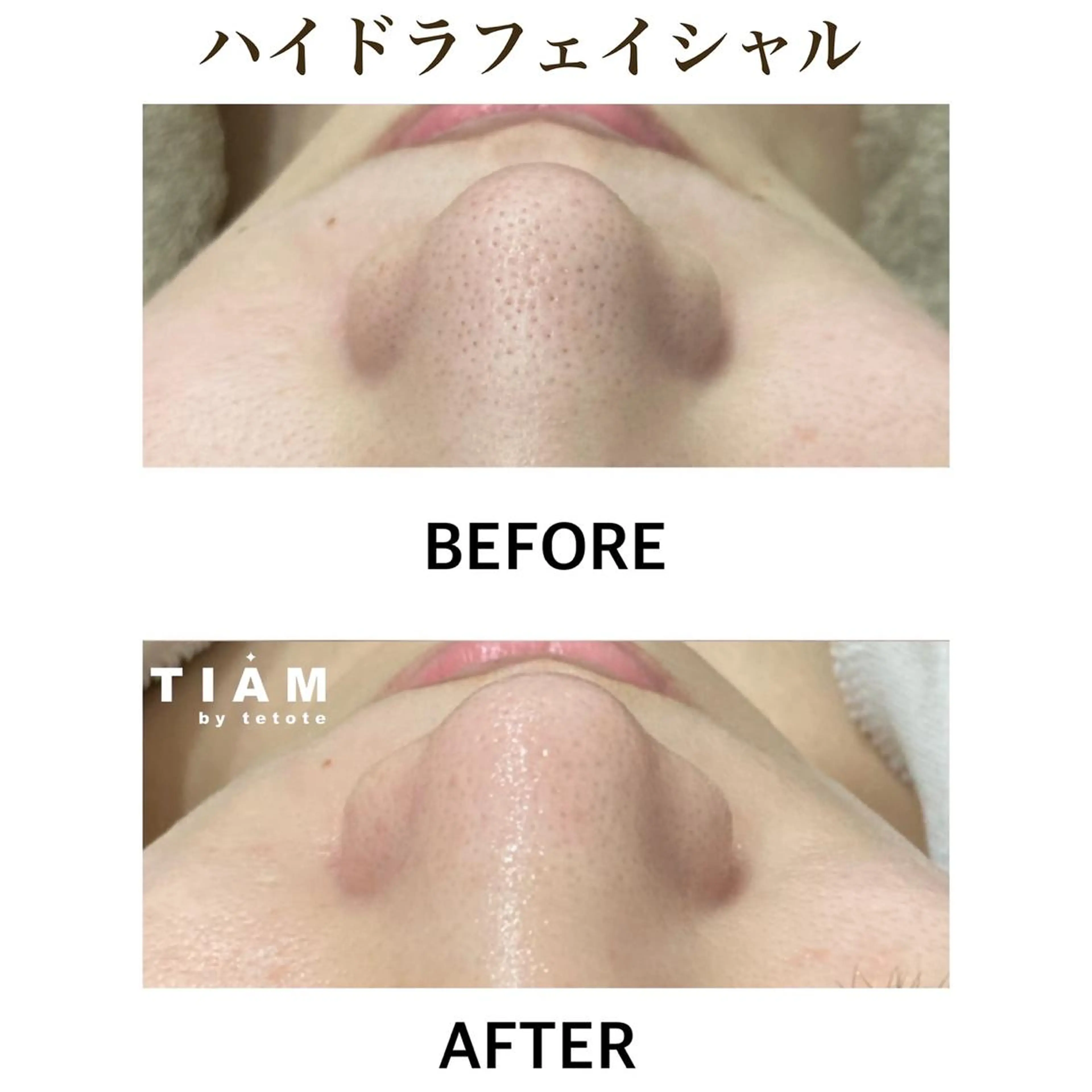 美肌サロンTIAM by tetoteのエステ・リラクイメージ