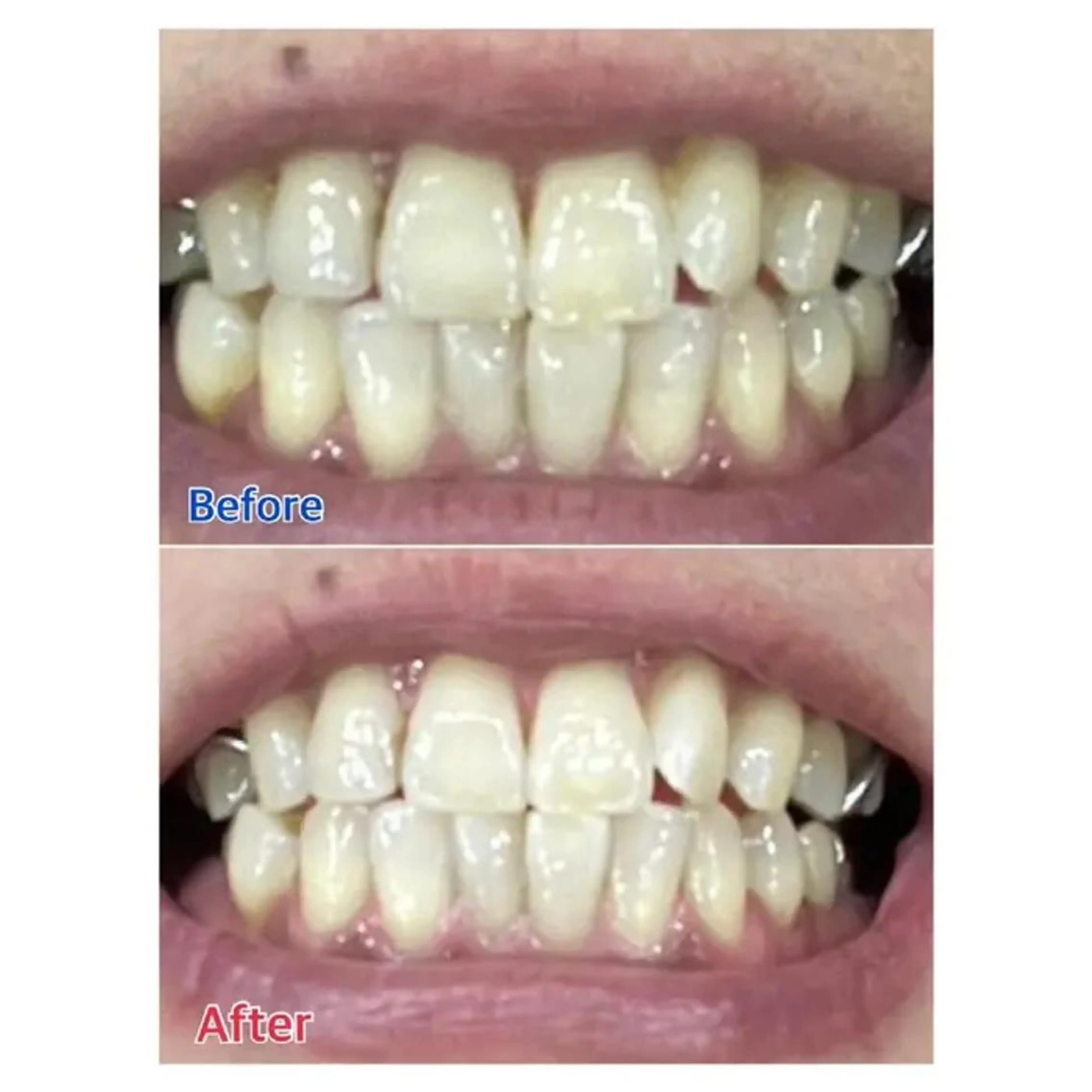 M渋谷店所属・M渋谷 ホワイトニングのエステ・リラクイメージ