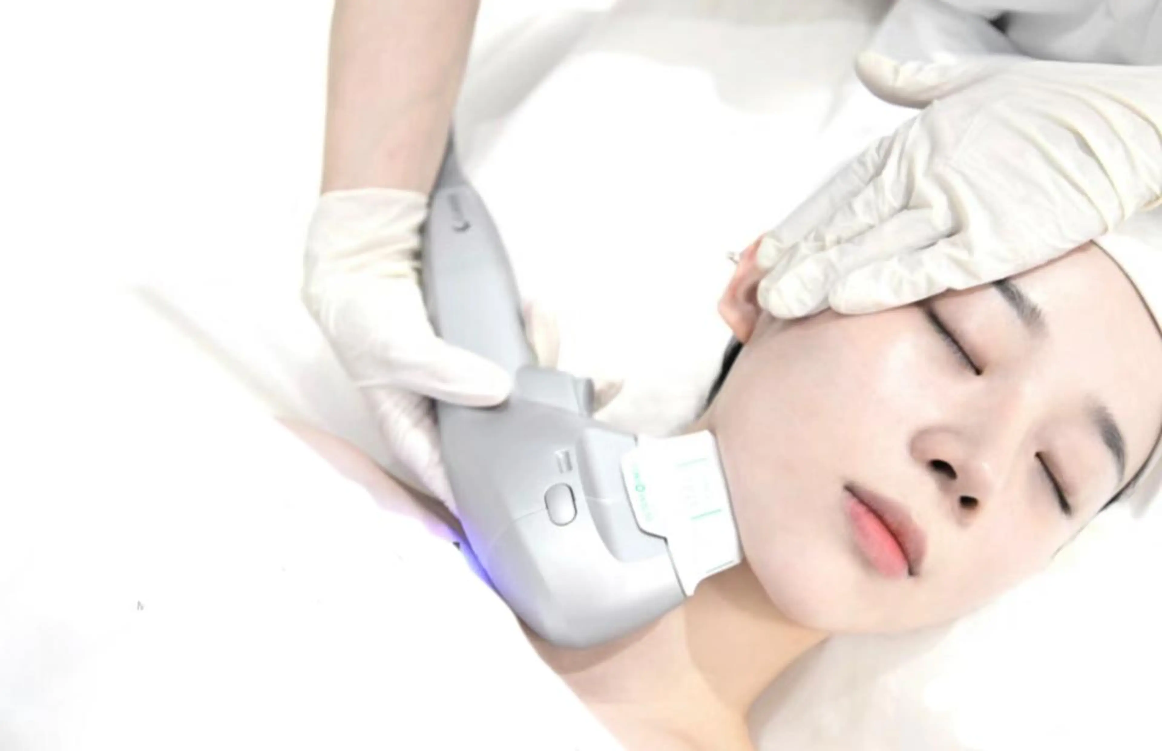 女性限定◆【最強小顔】三層打ち10000shot7DH I F U＋小顔コルギ＋上半身コルギ(癒すパック付き)の写真