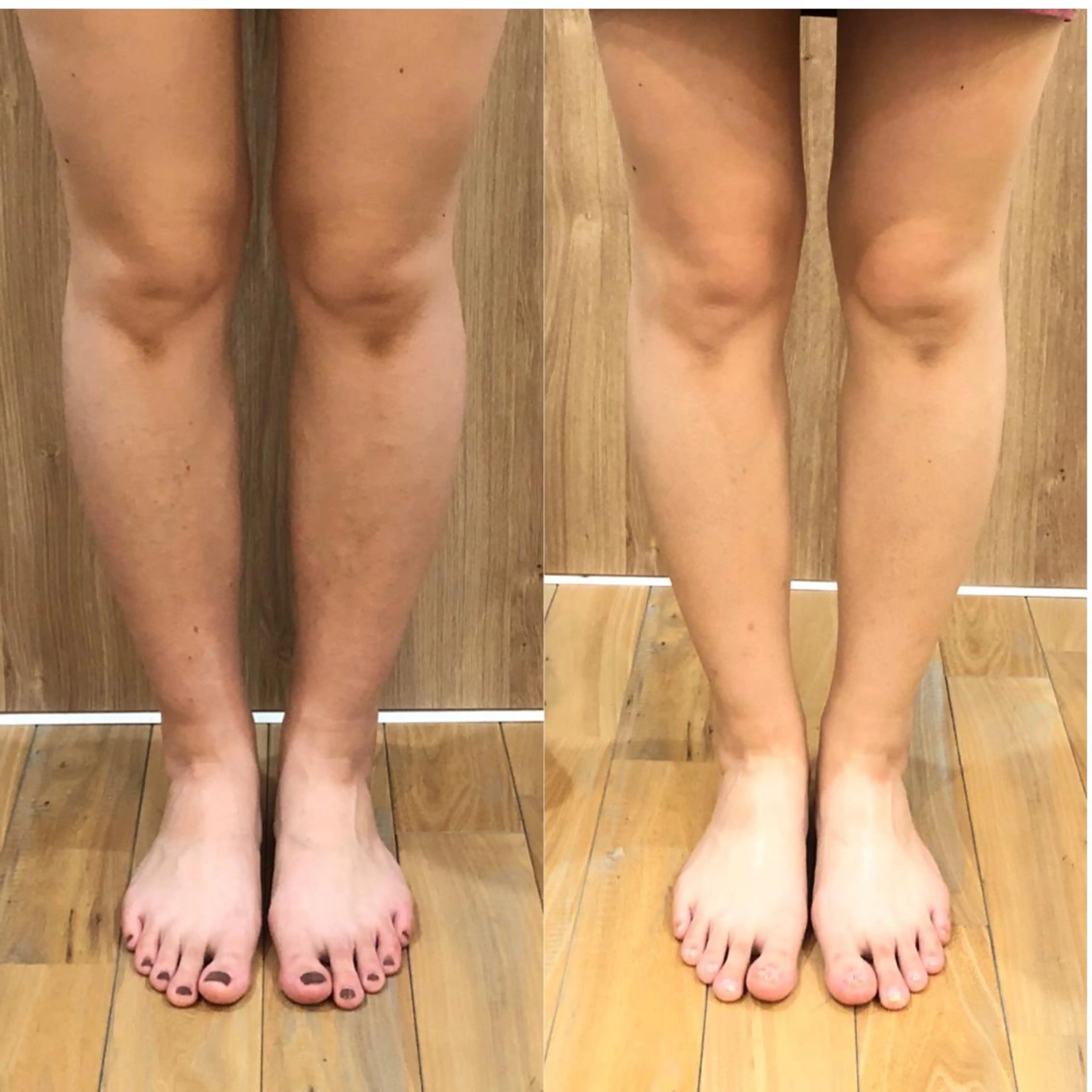 エステ インディバサロン　ソレイユ所属・indiba soleilのエステ・リラクイメージ