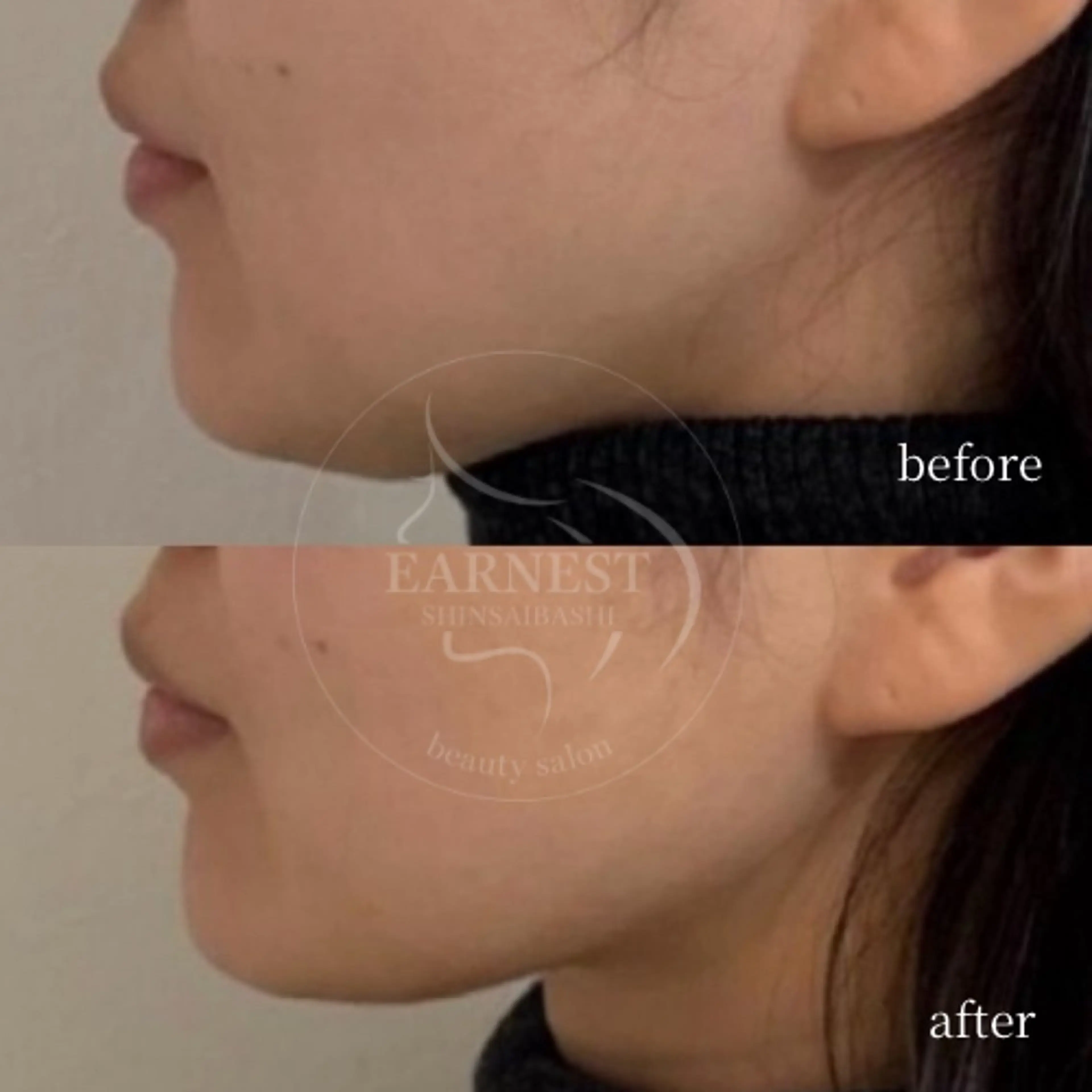 エステ 韓国肌管理・肌質改善 EARNEST心斎橋のエステ・リラクイメージ