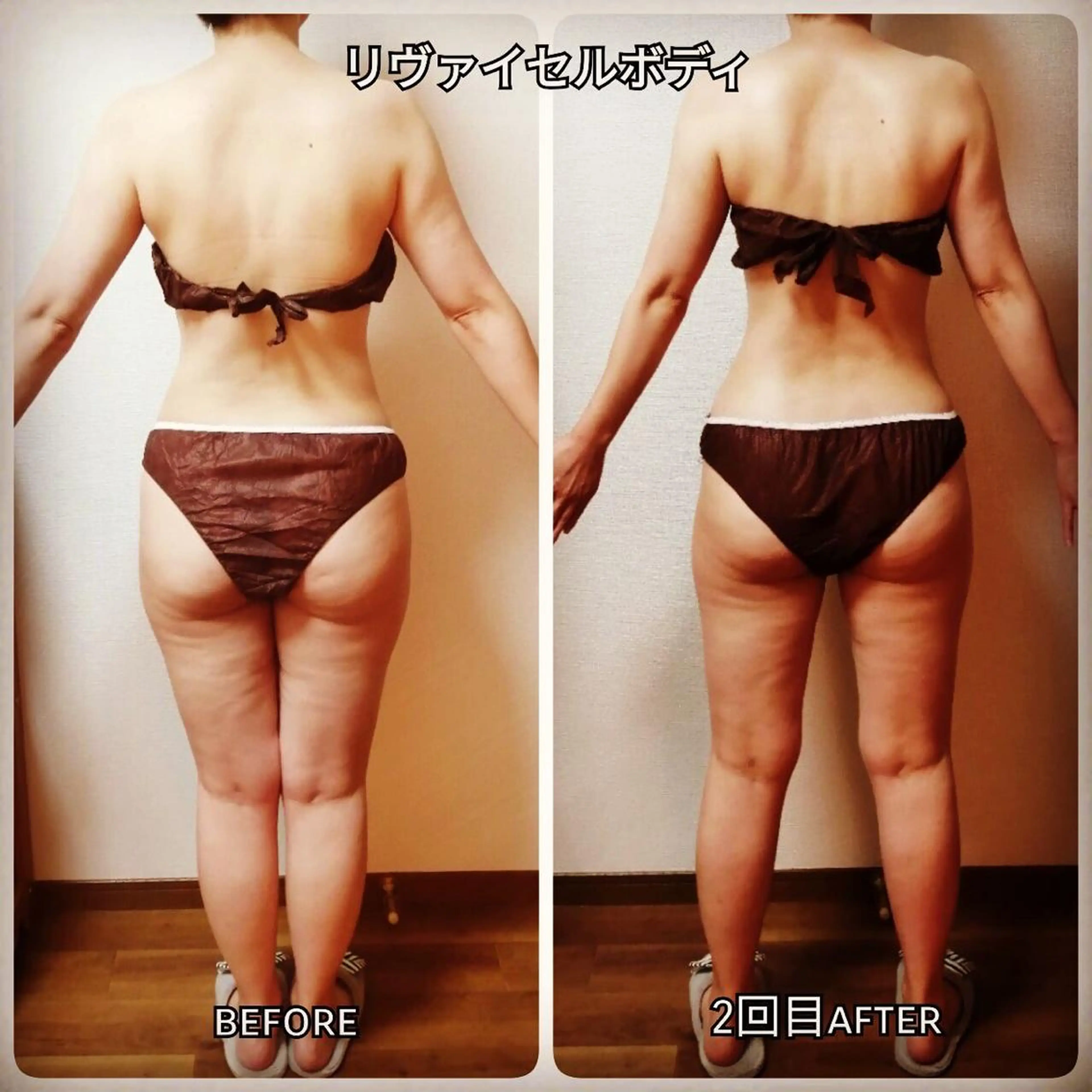 エステ リラク 未病ケアサロン　EMINY所属・未病ケアサロン EMINY☺︎勝俣のエステ・リラクイメージ