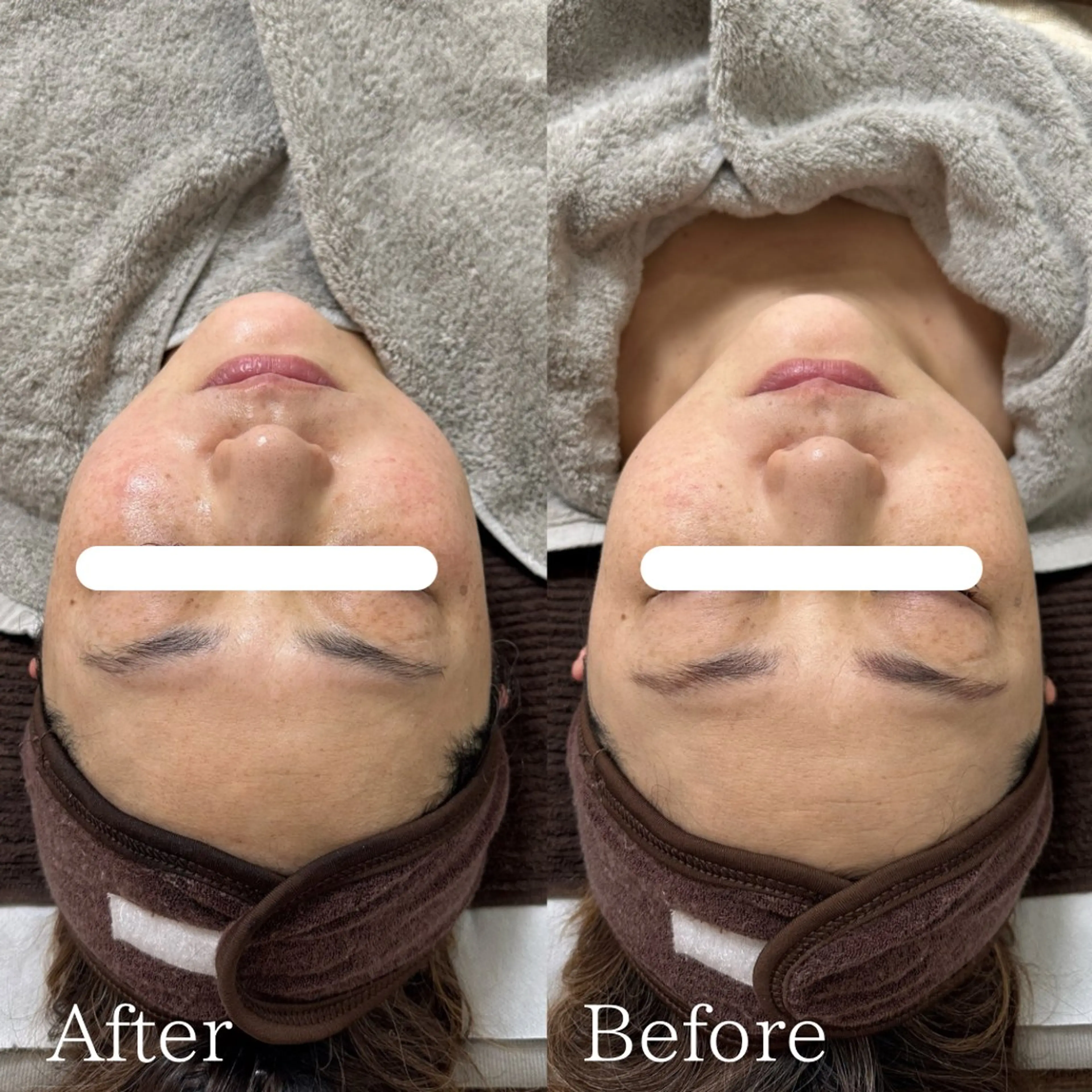 エステ lafleur Yurinaのエステ・リラクイメージ