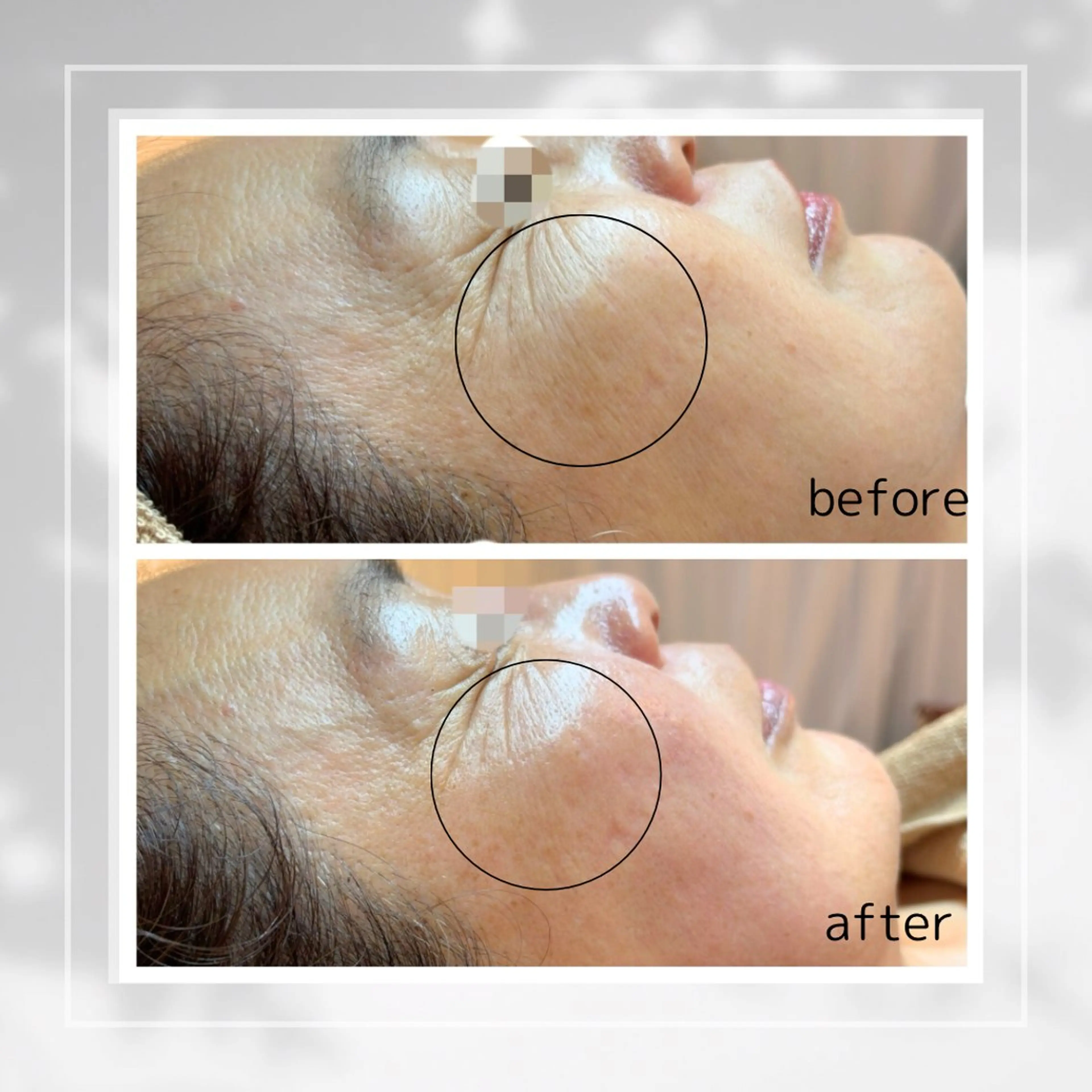 エステ 肌質改善フェイシャルCLEAR栄生/リンパ/毛穴/シミケア所属・井戸 麻衣のエステ・リラクイメージ