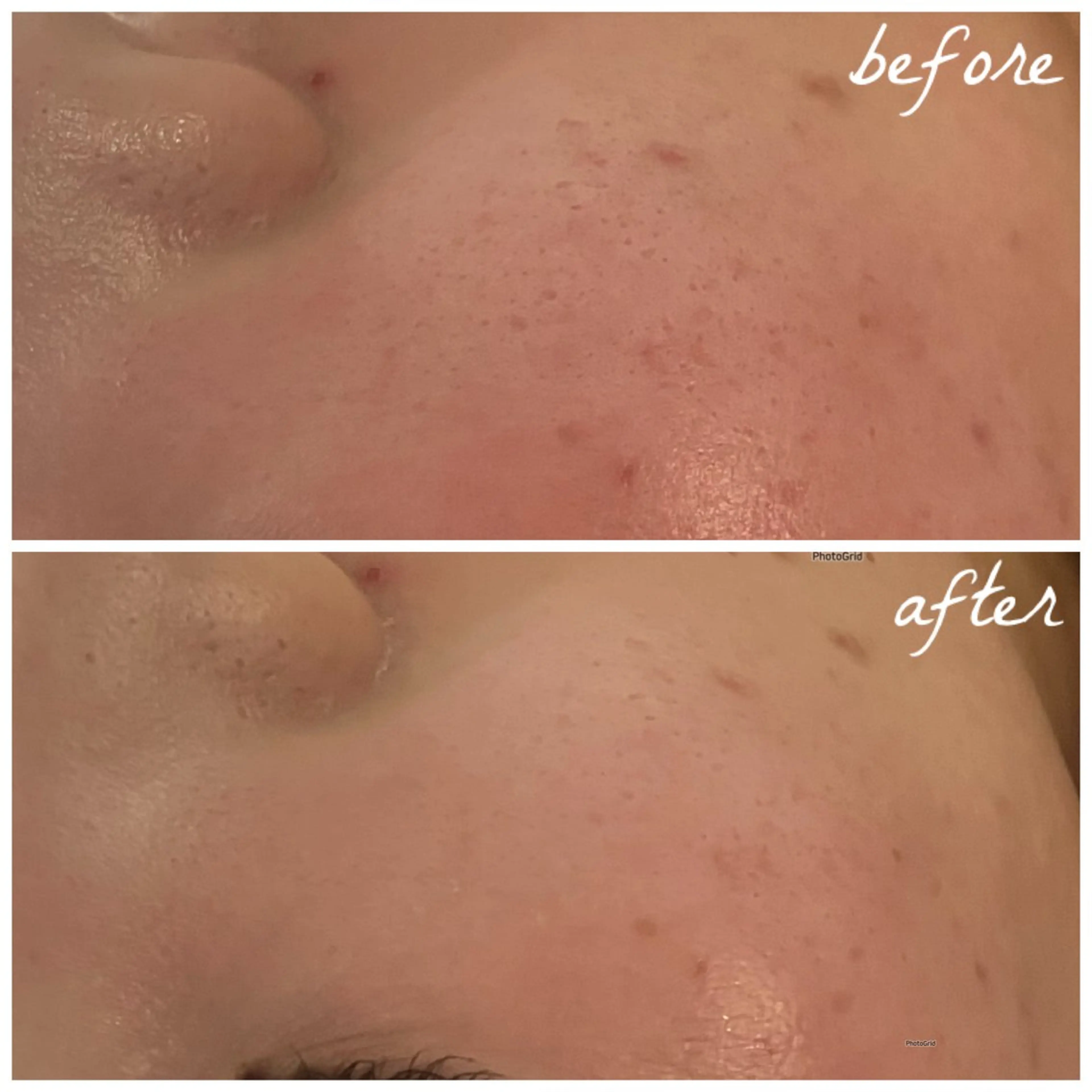 メンズ エステ メナード岐阜茜部 杉浦のエステ・リラクイメージ