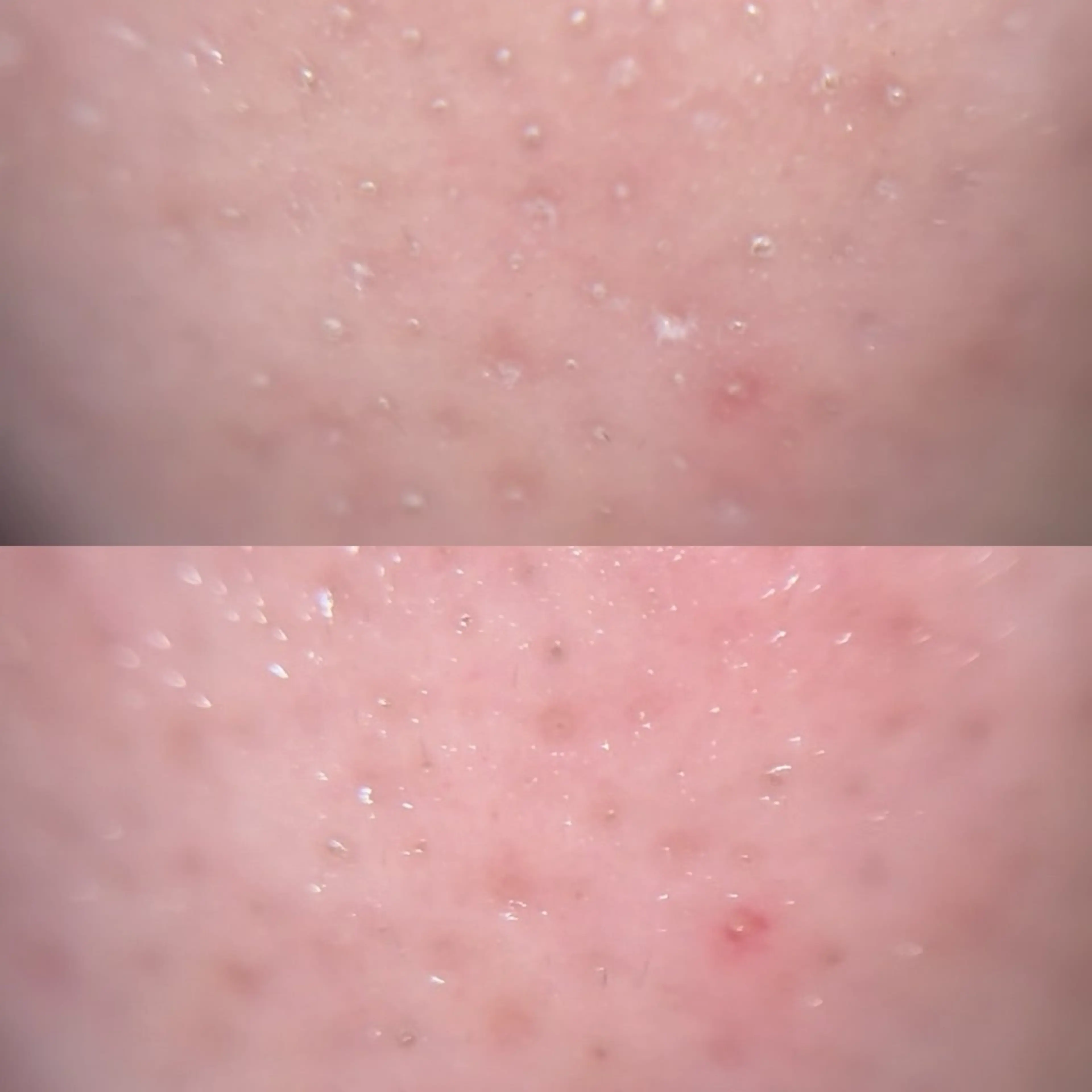 エステ リラク 毛穴ケア/毛穴診断/ 毛穴洗浄〔心斎橋〕のエステ・リラクイメージ