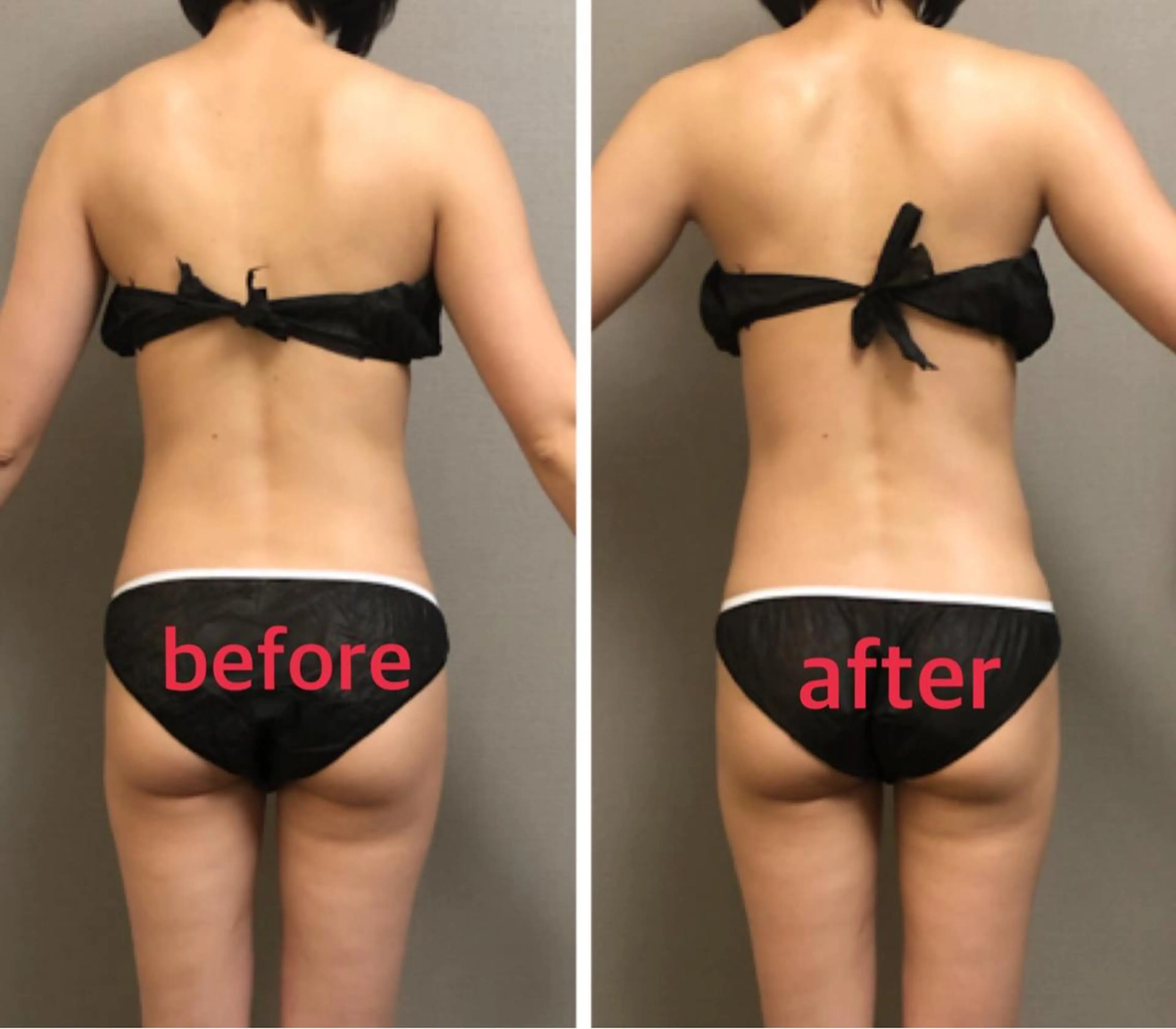 エステ リラク 美ola ビオラのエステ・リラクイメージ