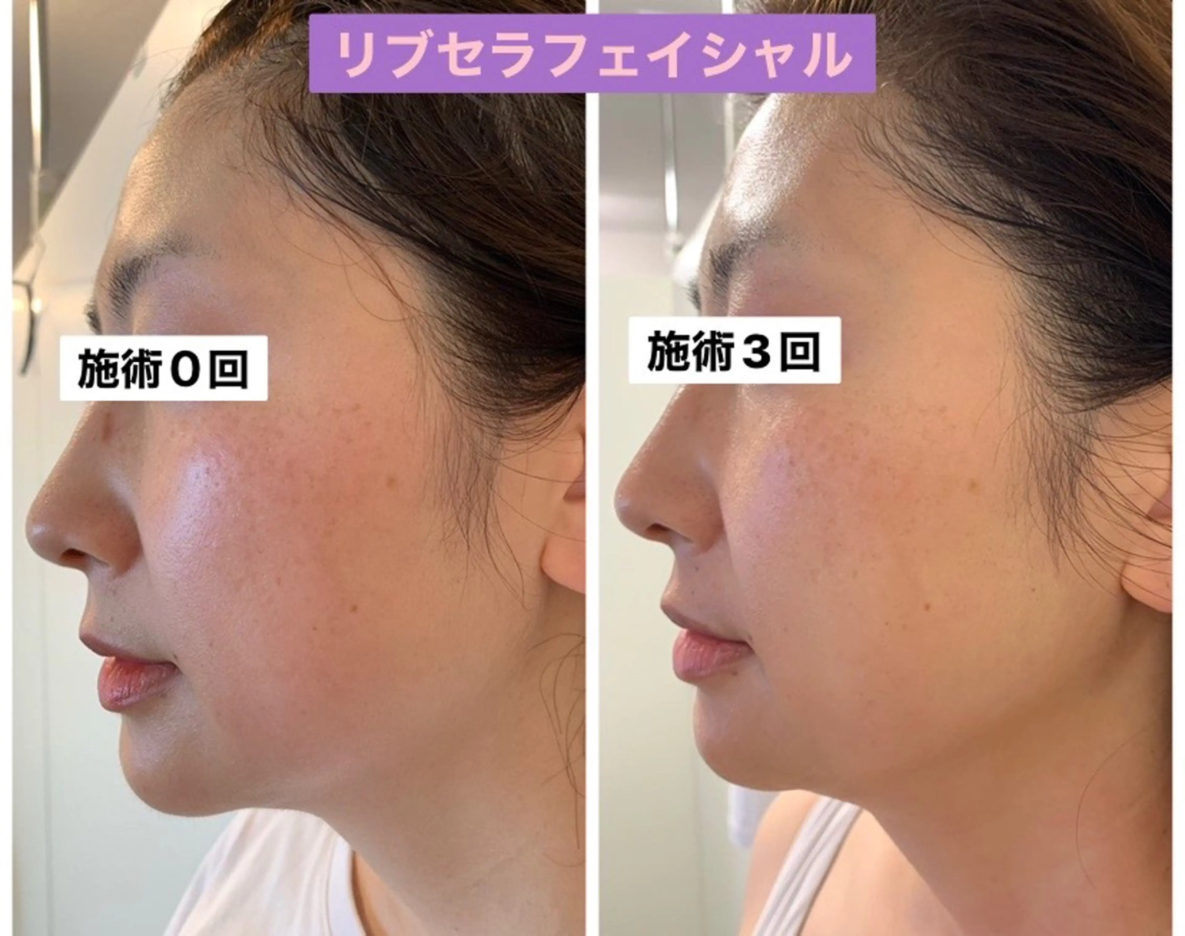 エステ Private Salon Prunelle所属・プライベートサロン プリュネルのエステ・リラクイメージ