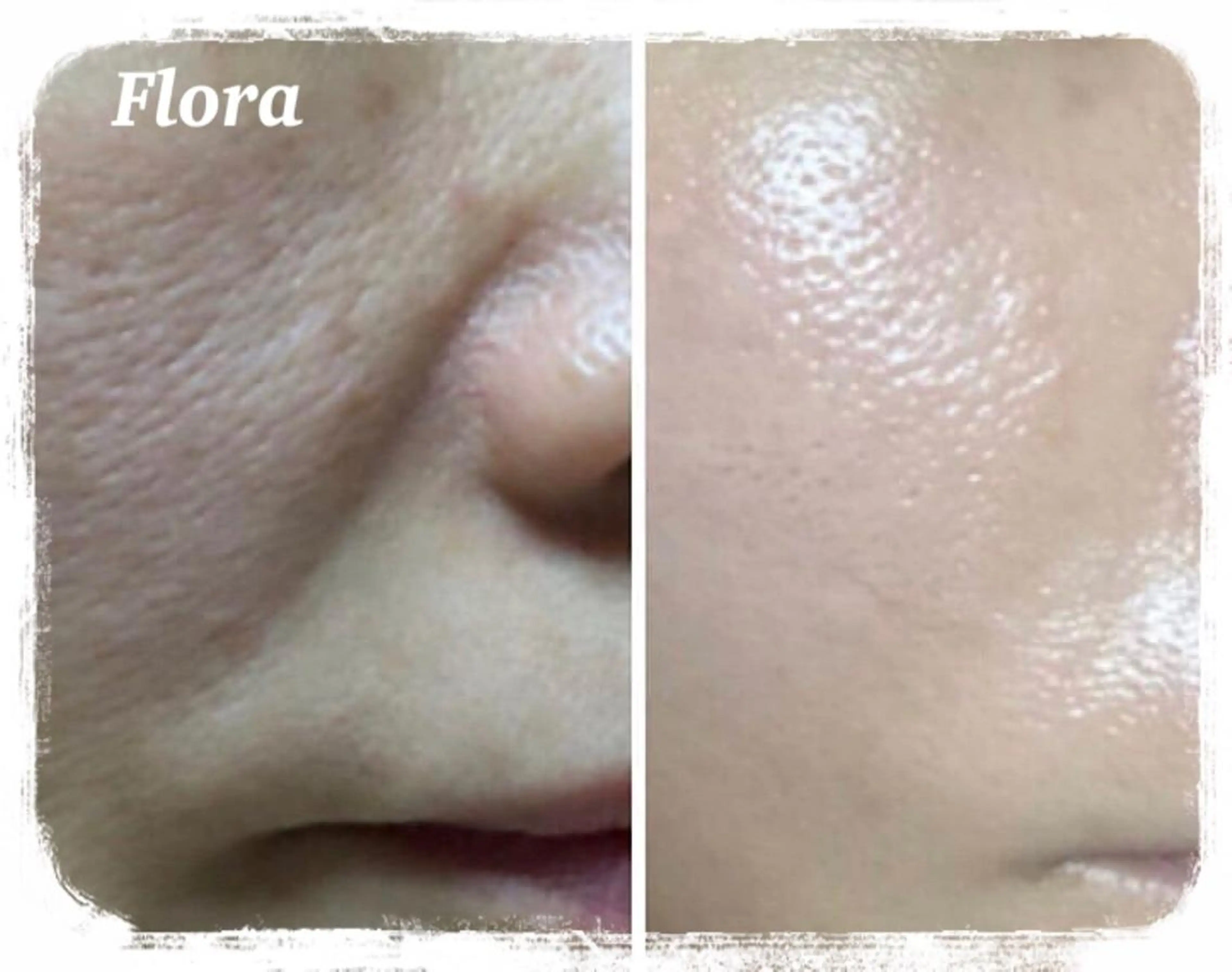 温活痩身エステ Floraのエステ・リラクイメージ