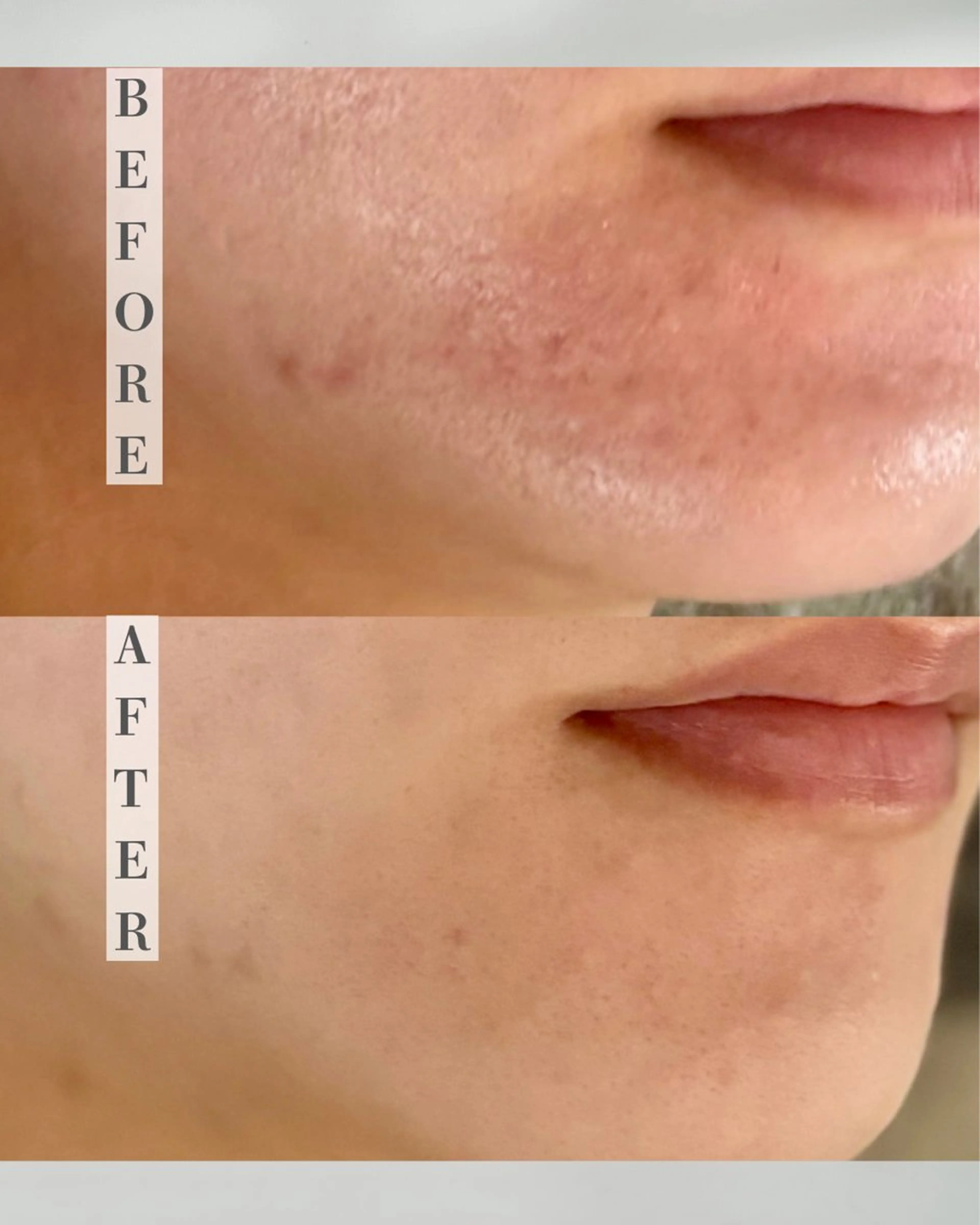 カムイ所属・カムイ 山﨑のエステ・リラクイメージ