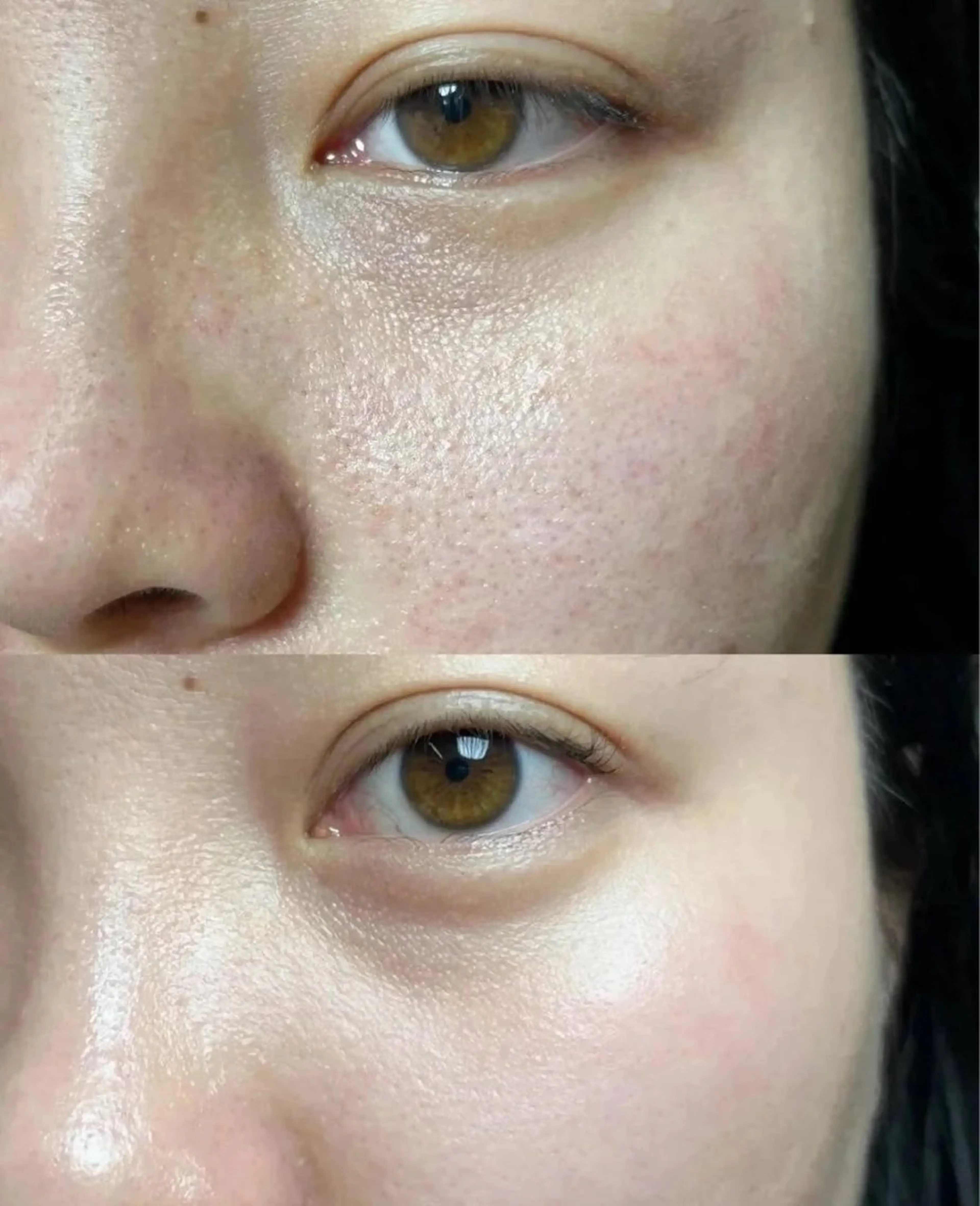 ネイル エステ aliaハイフ&水光ジェットサロン所属・aliaハーブ水光店 エステティシャン募集のエステ・リラクイメージ