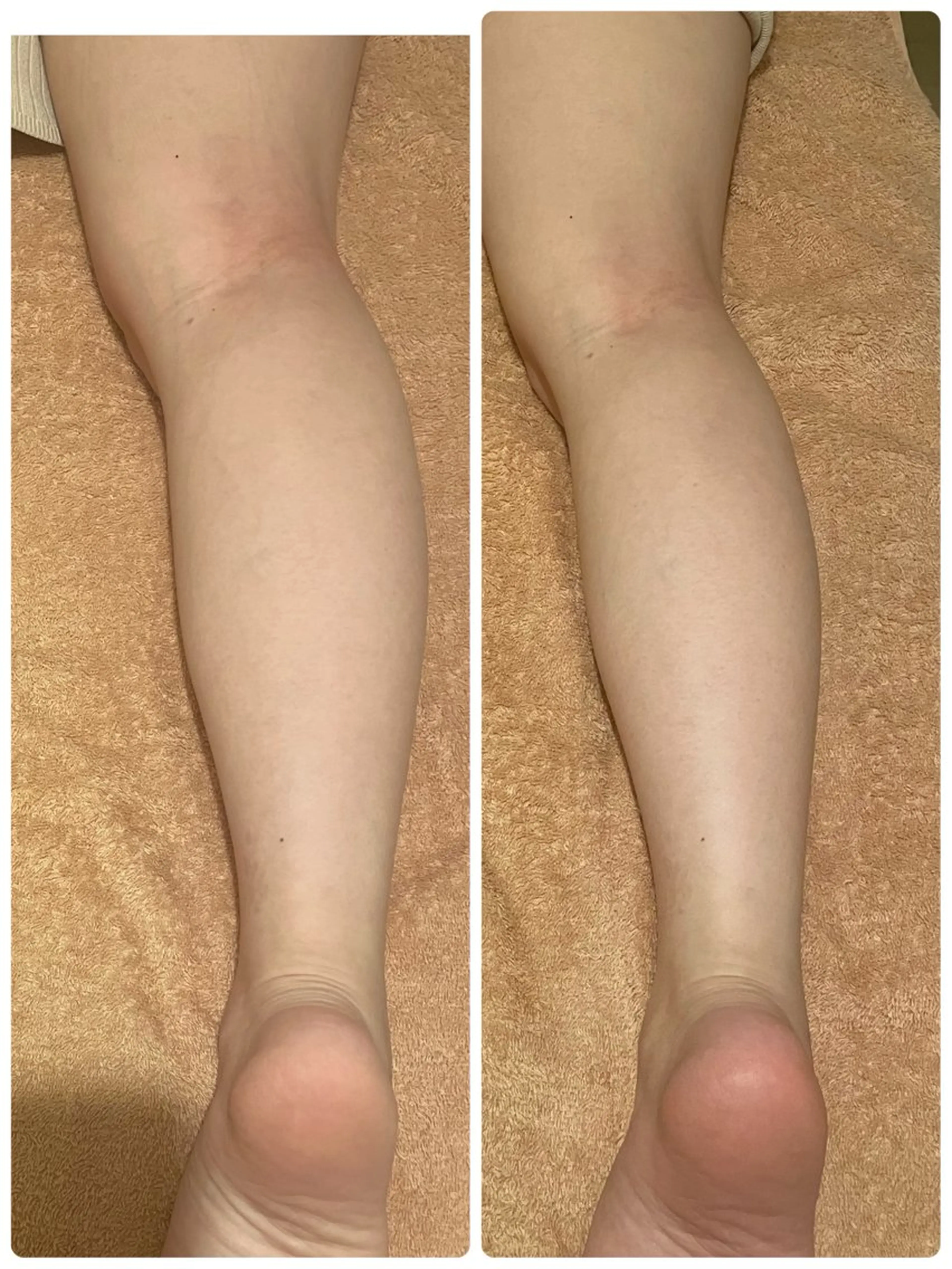 ロミロミ ・艶肌小顔 RIEのエステ・リラクイメージ