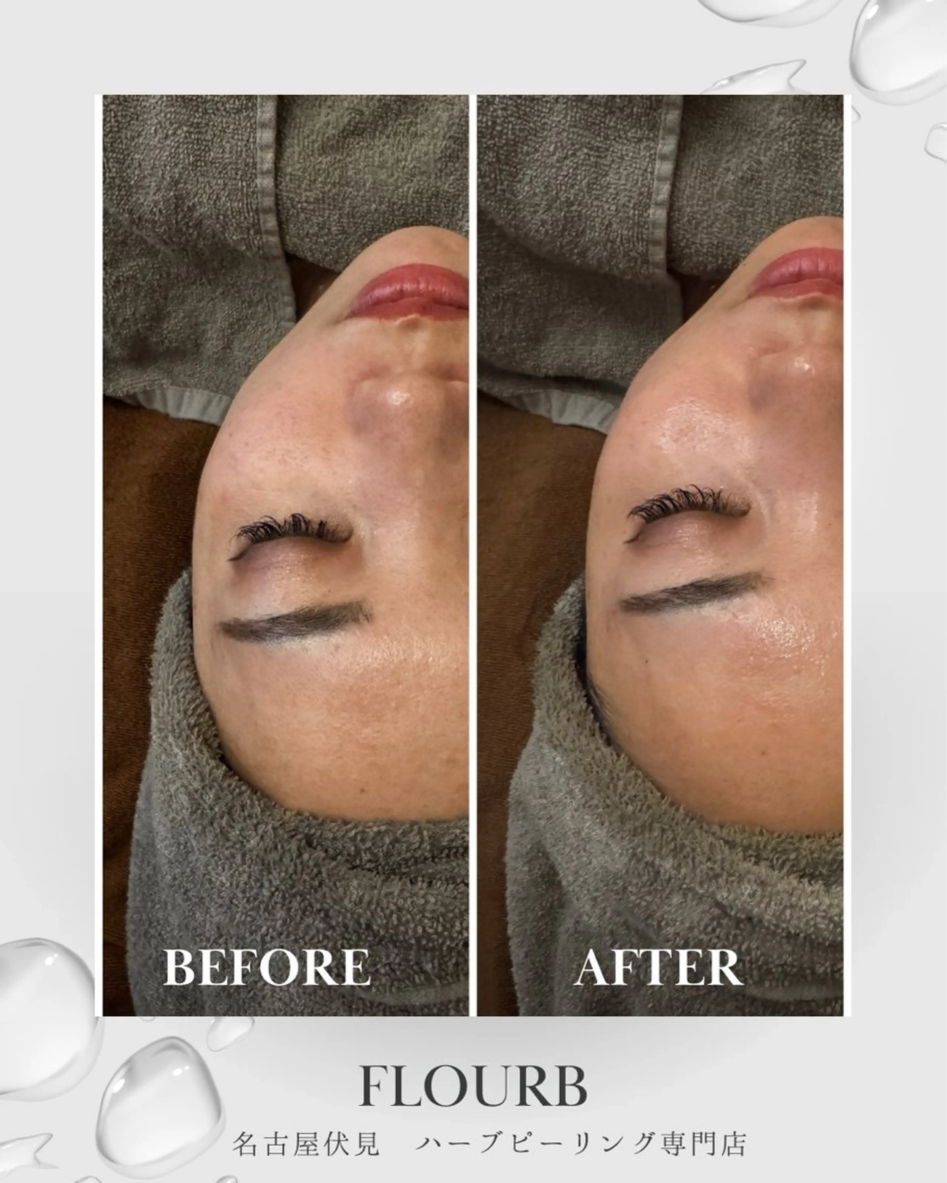 エステ Flourb所属・ハーブピーリング専門 サロンFlourbのエステ・リラクイメージ