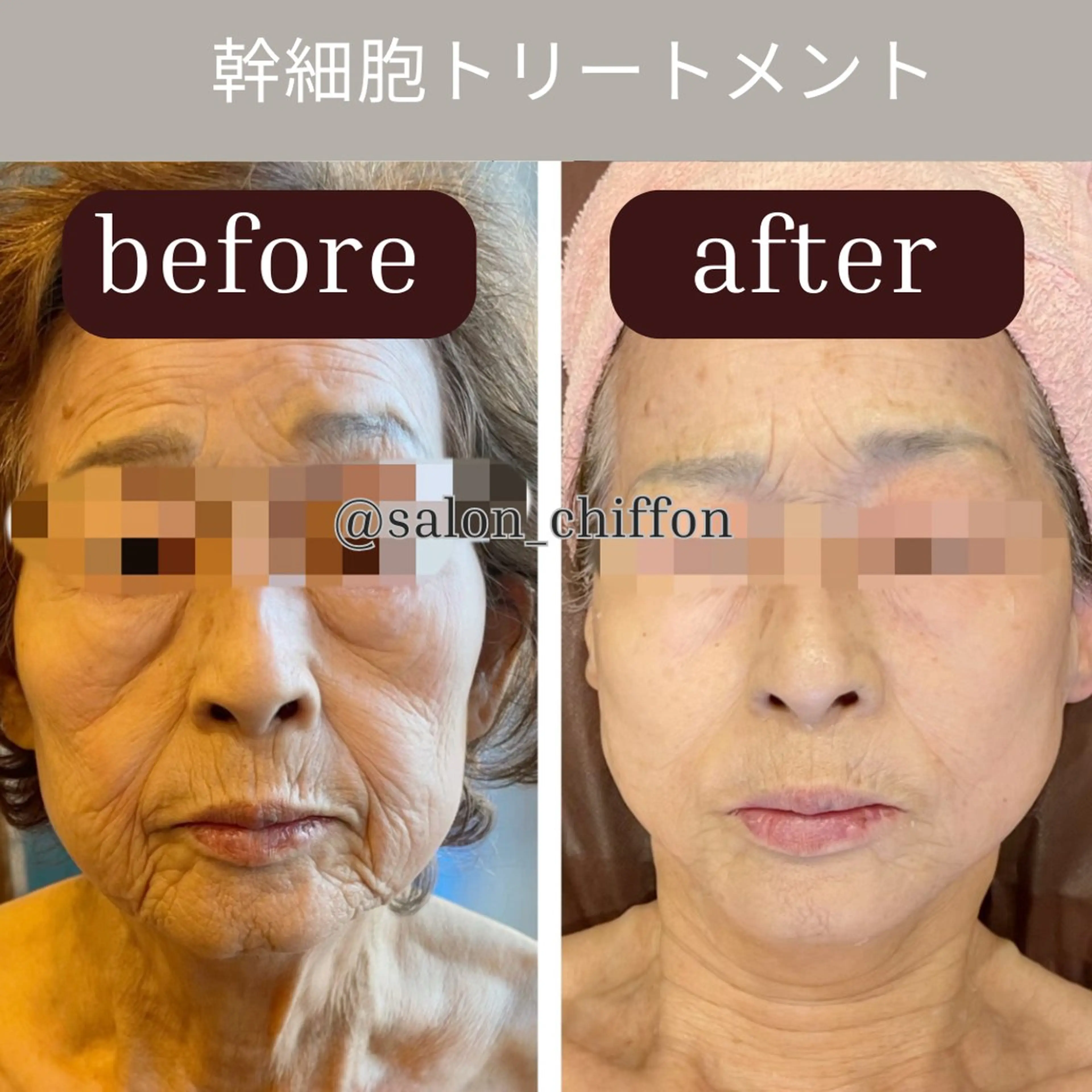 肌質改善エステ chiffonのエステ・リラクイメージ