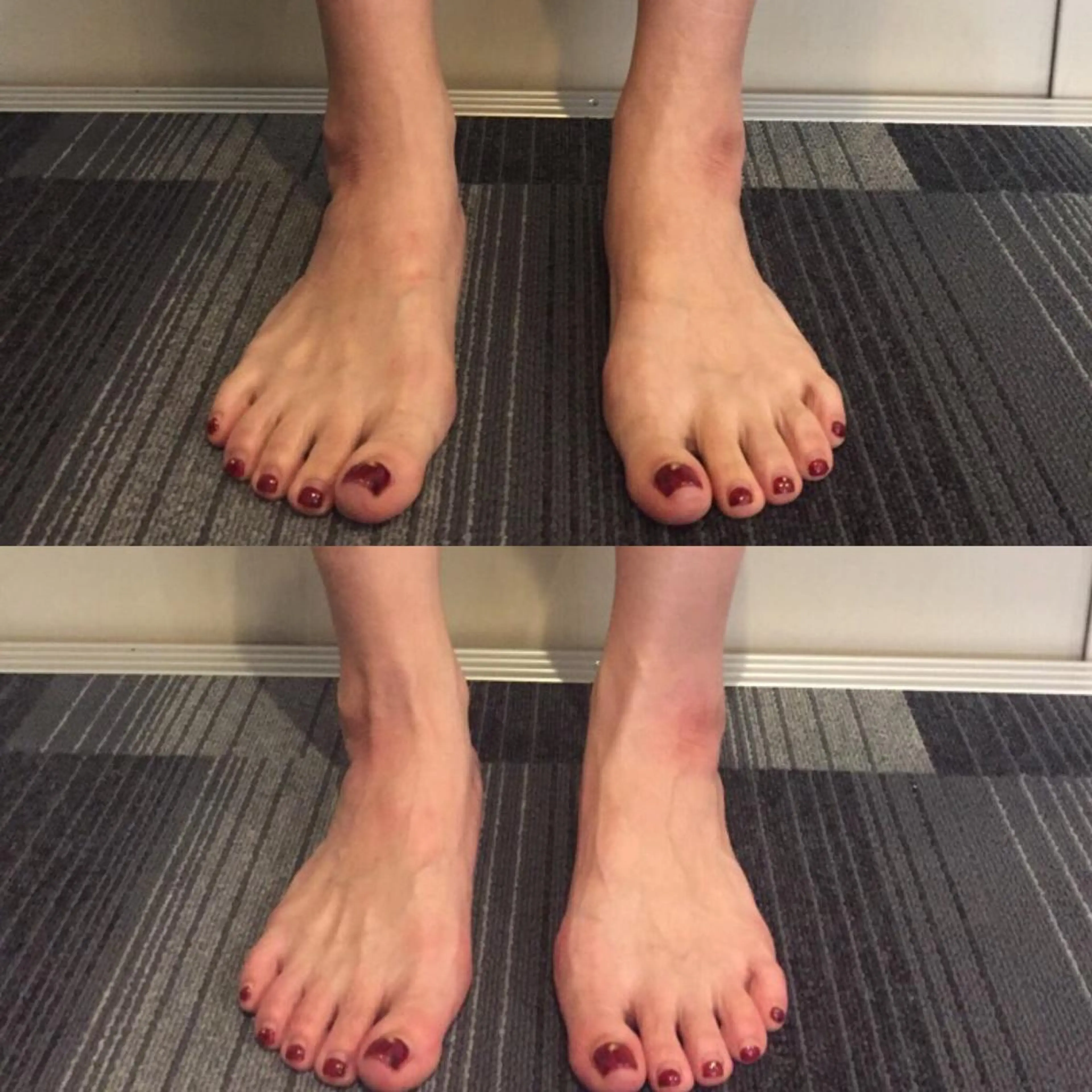 HappIness 遠赤外線ドームのエステ・リラクイメージ