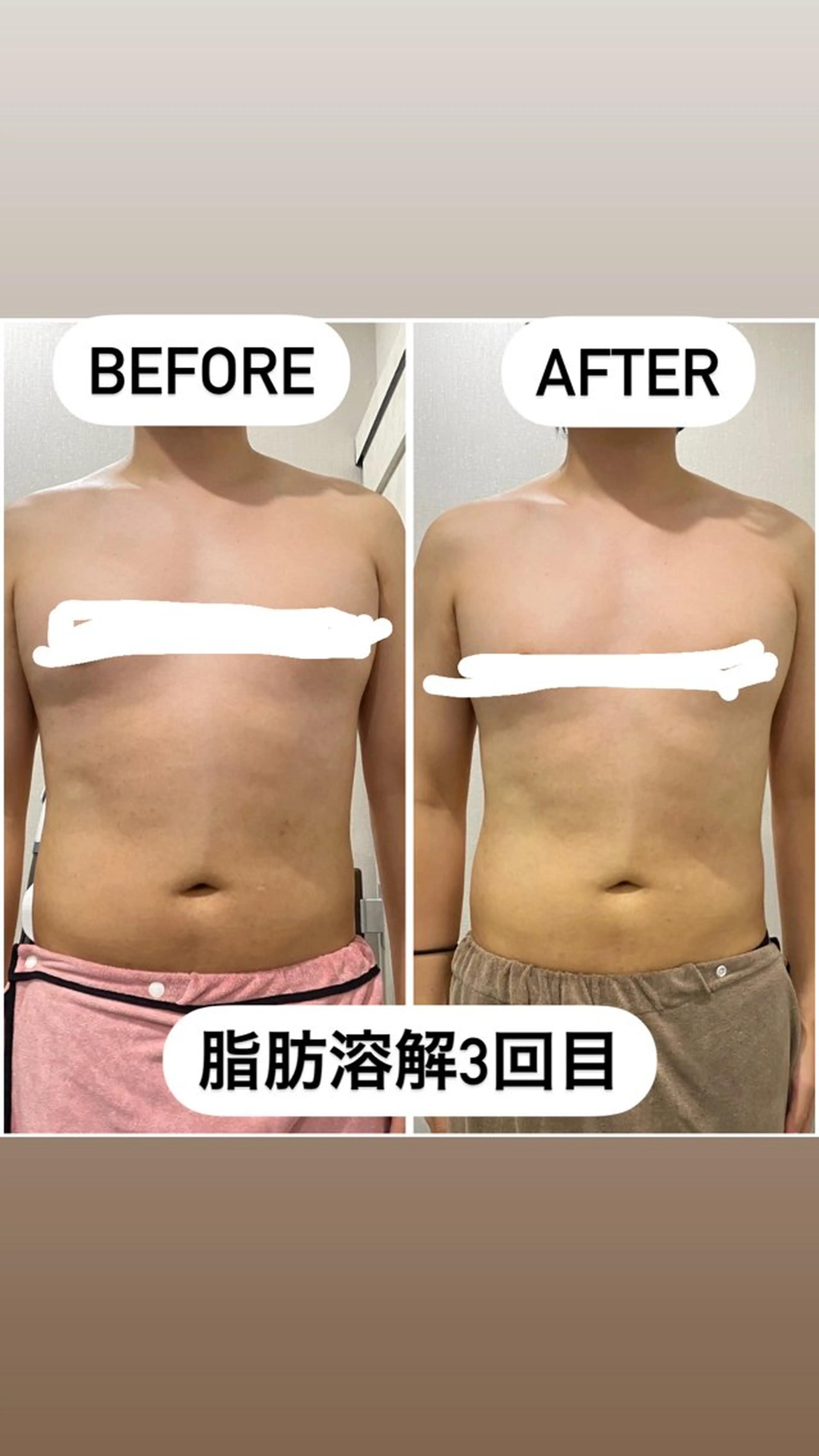 エステ アルカンジュ~archange~所属・痩身/毛穴洗浄/脱毛 アルカンジュのエステ・リラクイメージ