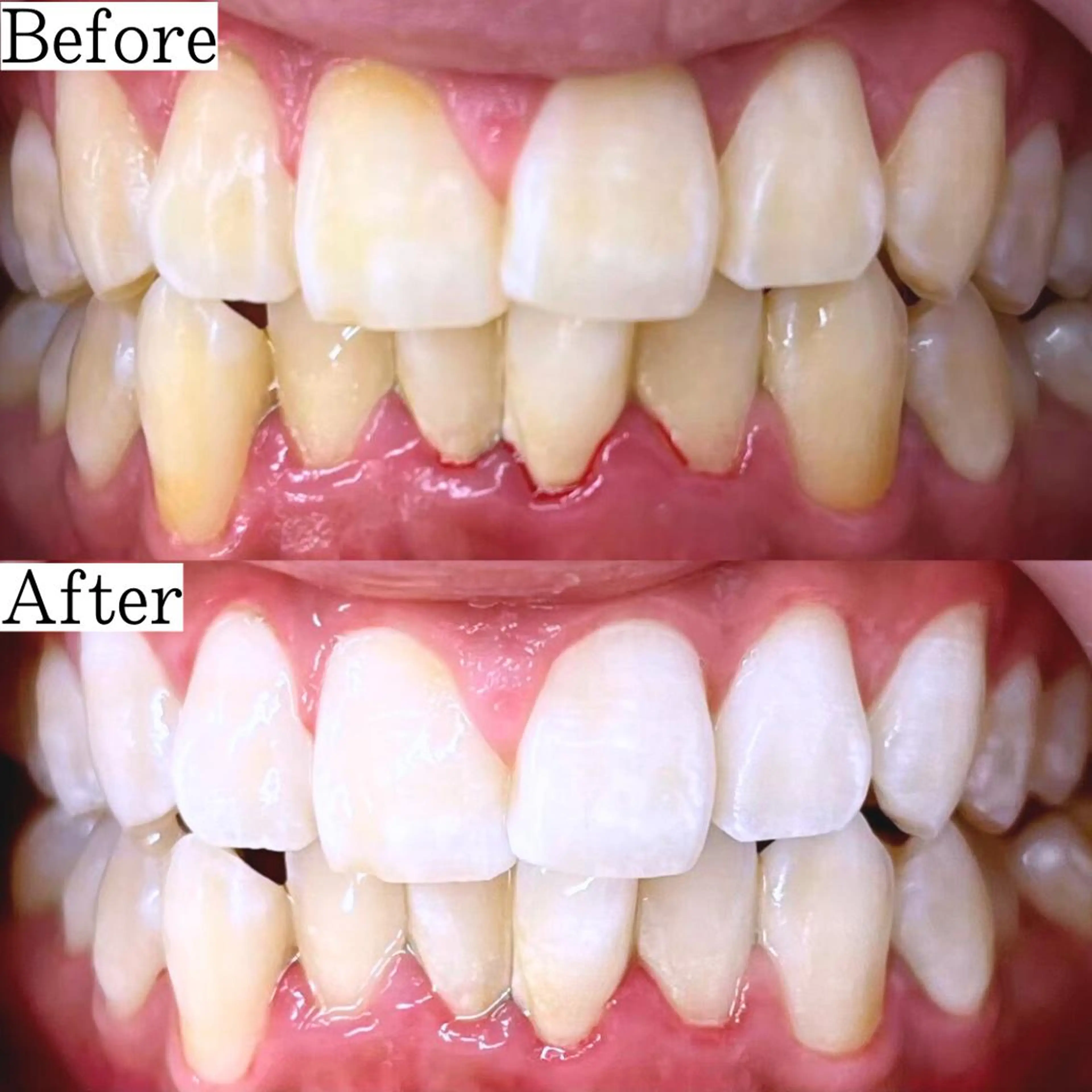 LBSホワイトニング 銀座店💎公式のその他イメージ