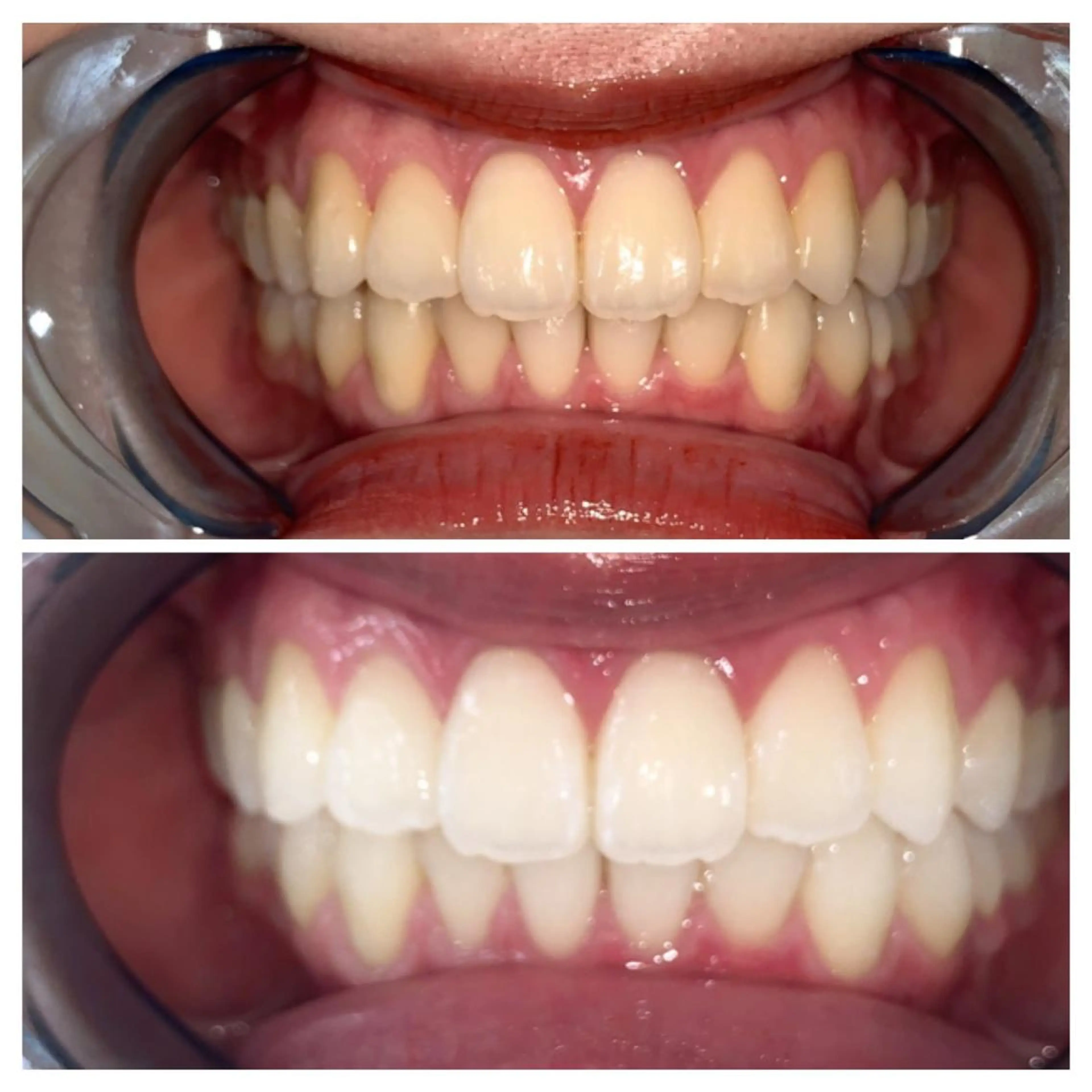 ネイル ヘアアレンジ ロング カラー メンズ マツエク・マツパ アイブロウ キッズ パーマ エステ リラク ライトビューティー 銀座店のエステ・リラクイメージ