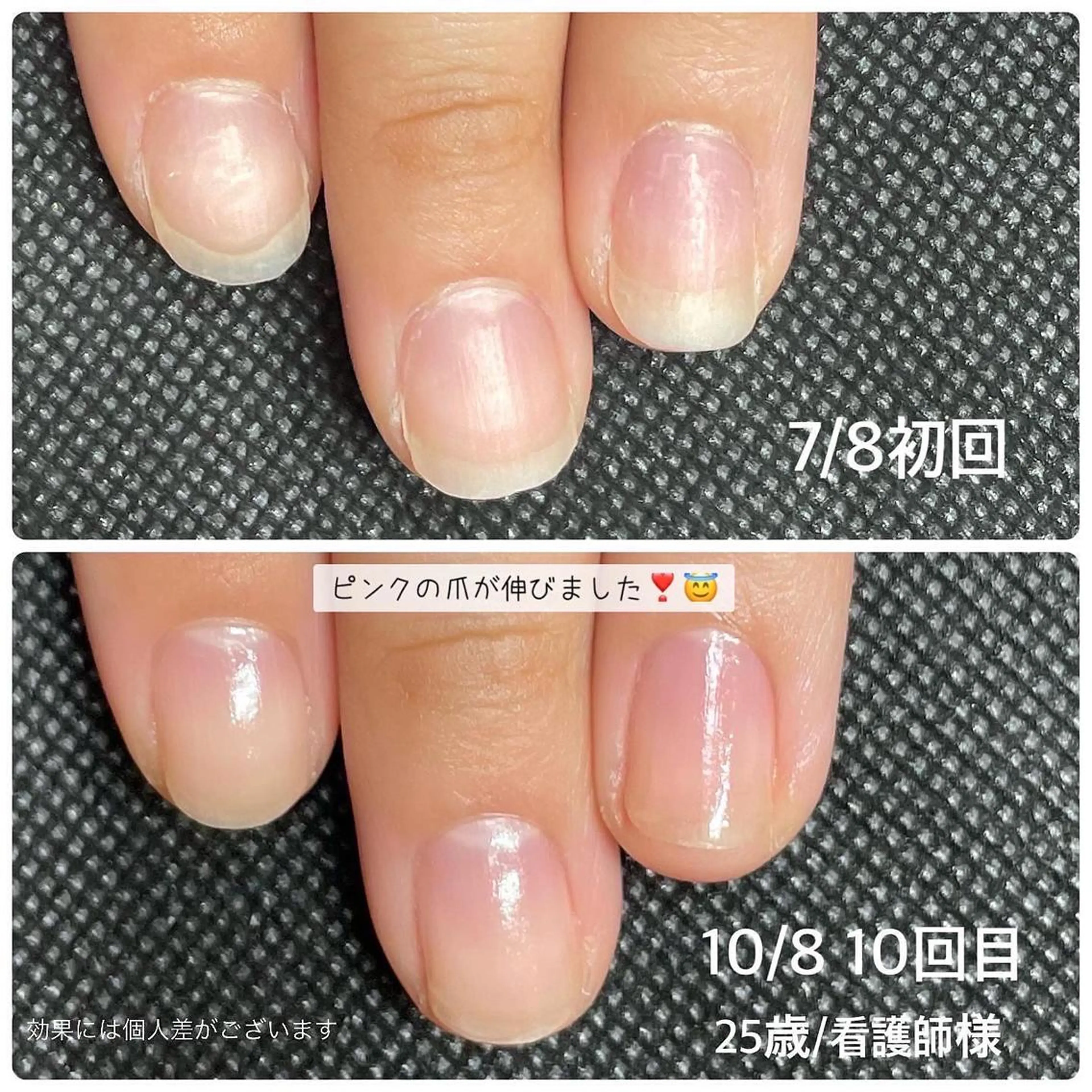 ネイル 奥園 良恵のネイルデザイン