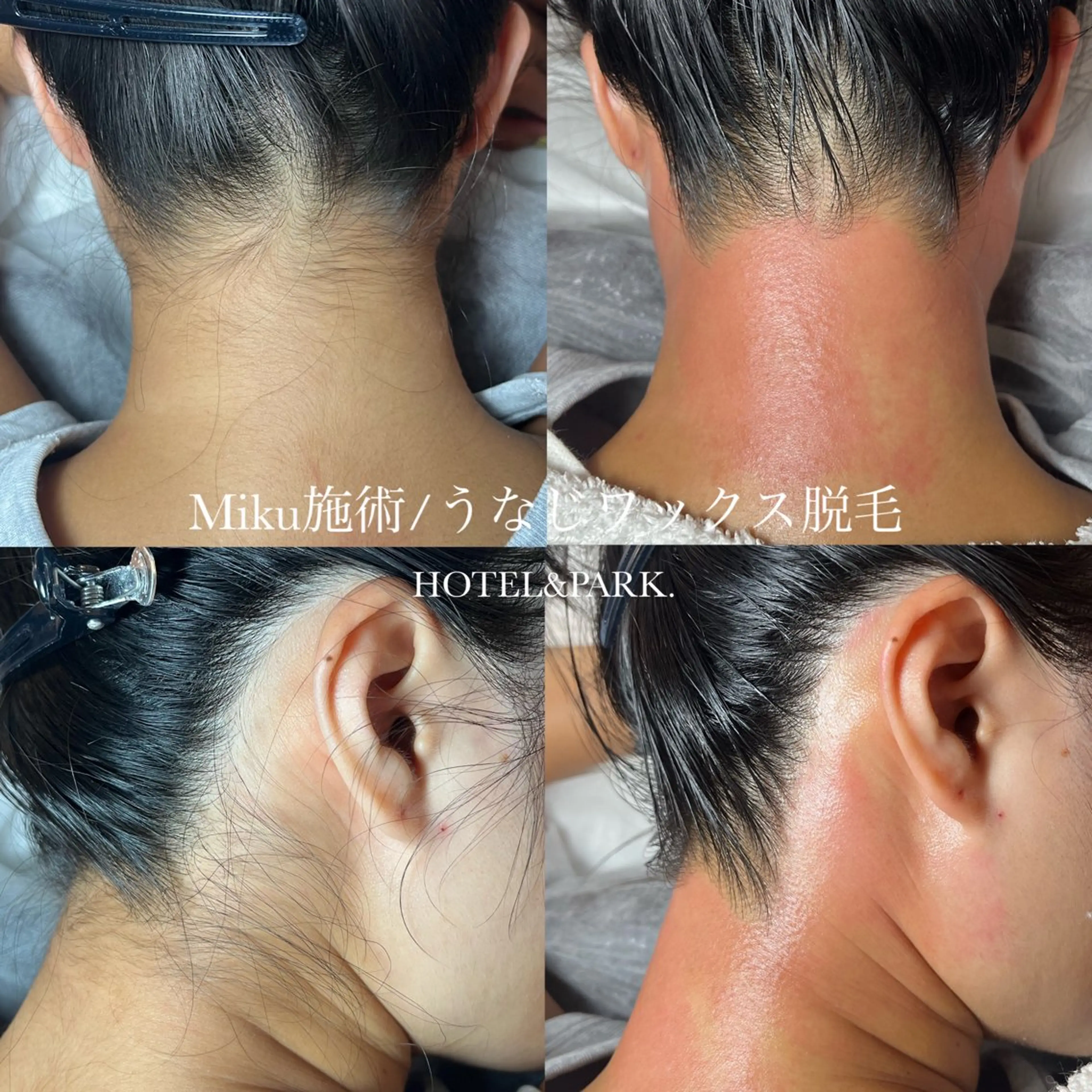 脱毛 HOTEL&PARK Mikuワックス脱毛のエステ・リラクイメージ