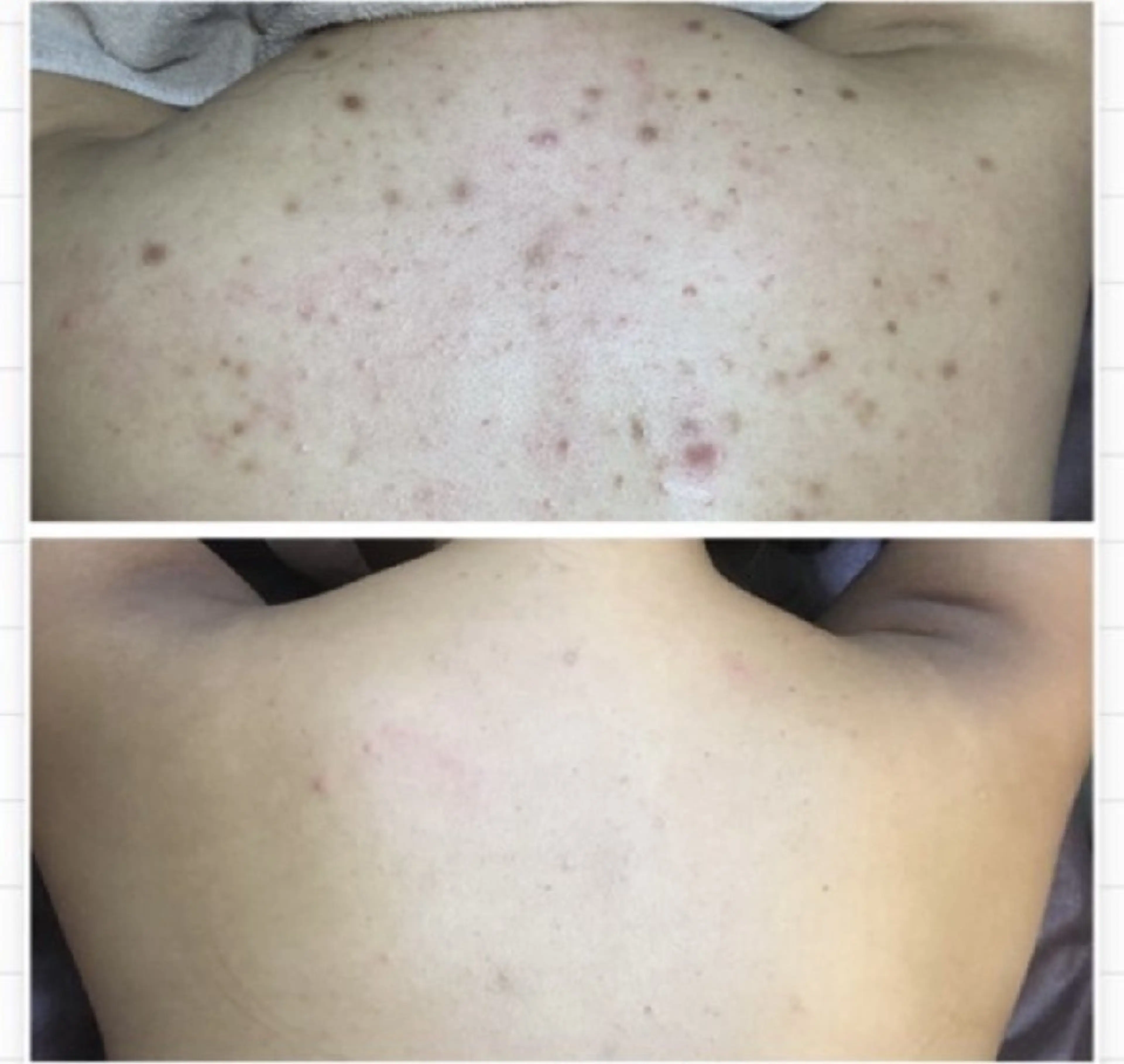 エステ ハーブピーリング専門 COCO.梅田中津のエステ・リラクイメージ